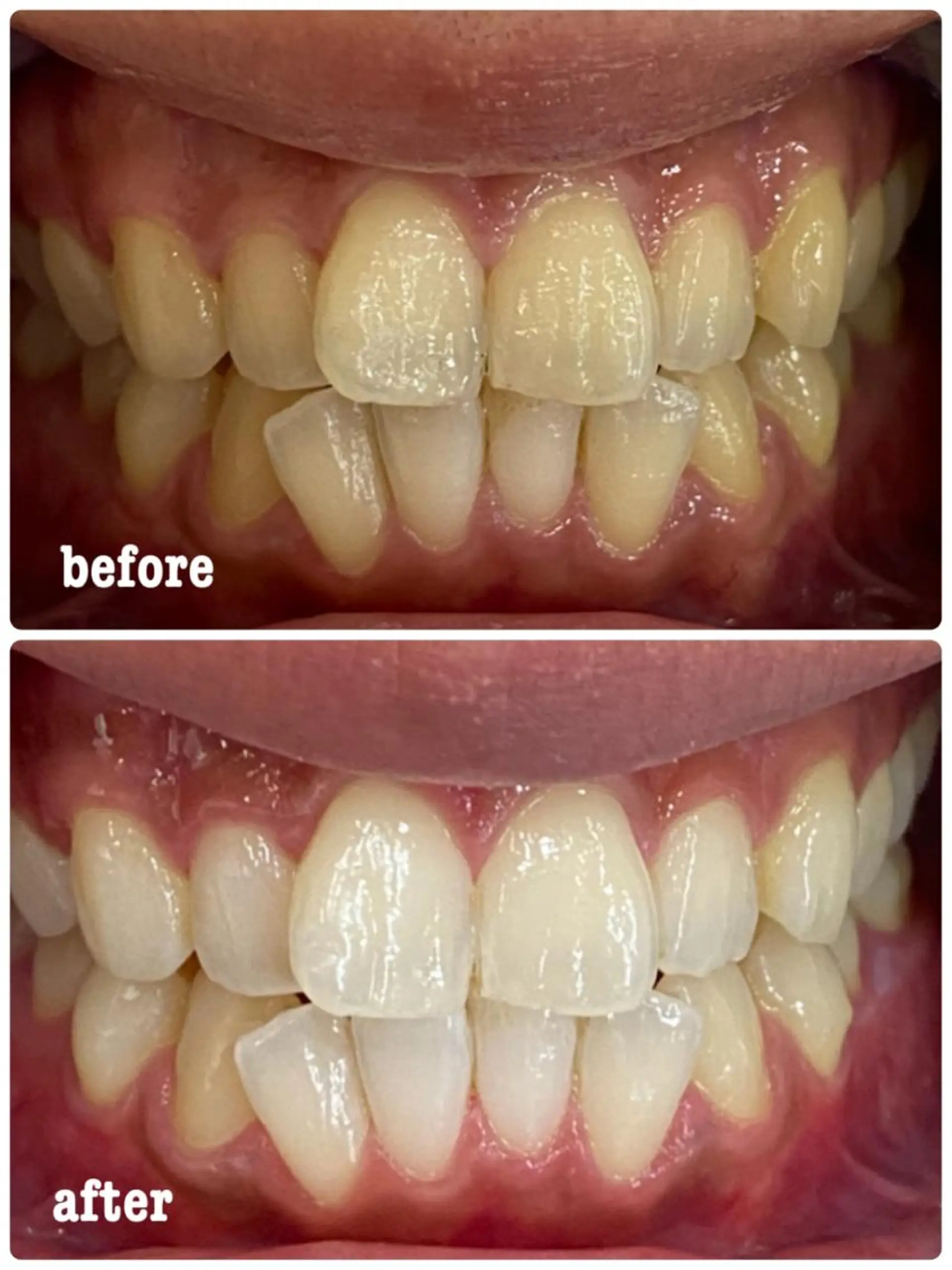 ホワイトニングサロン ラウレアのその他イメージ