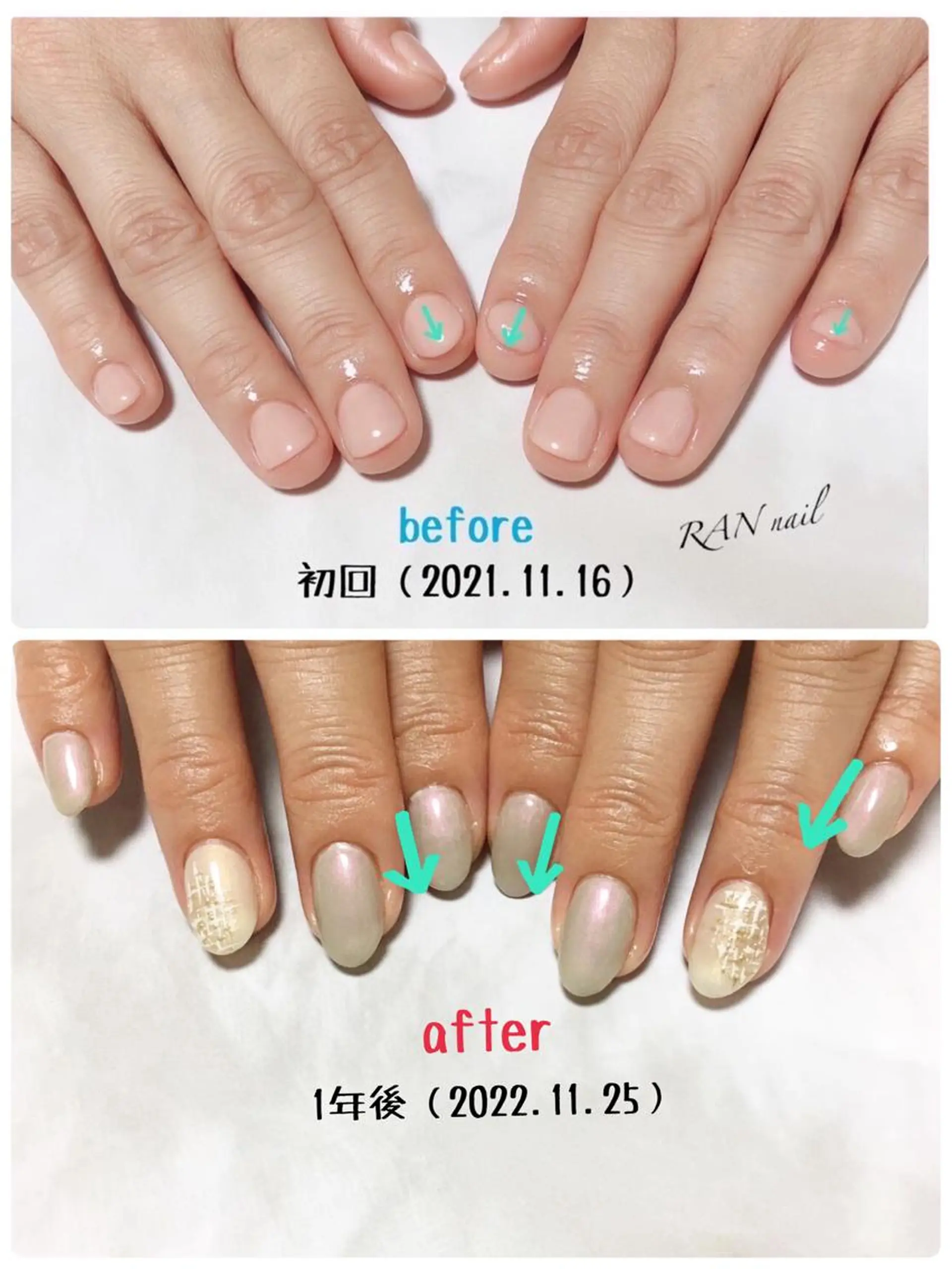 ネイル クリアネイル 成人式 フレンチネイル ジェルネイル ラメ(グリッター) ハンドネイル フットネイル RAN nailのネイルデザイン