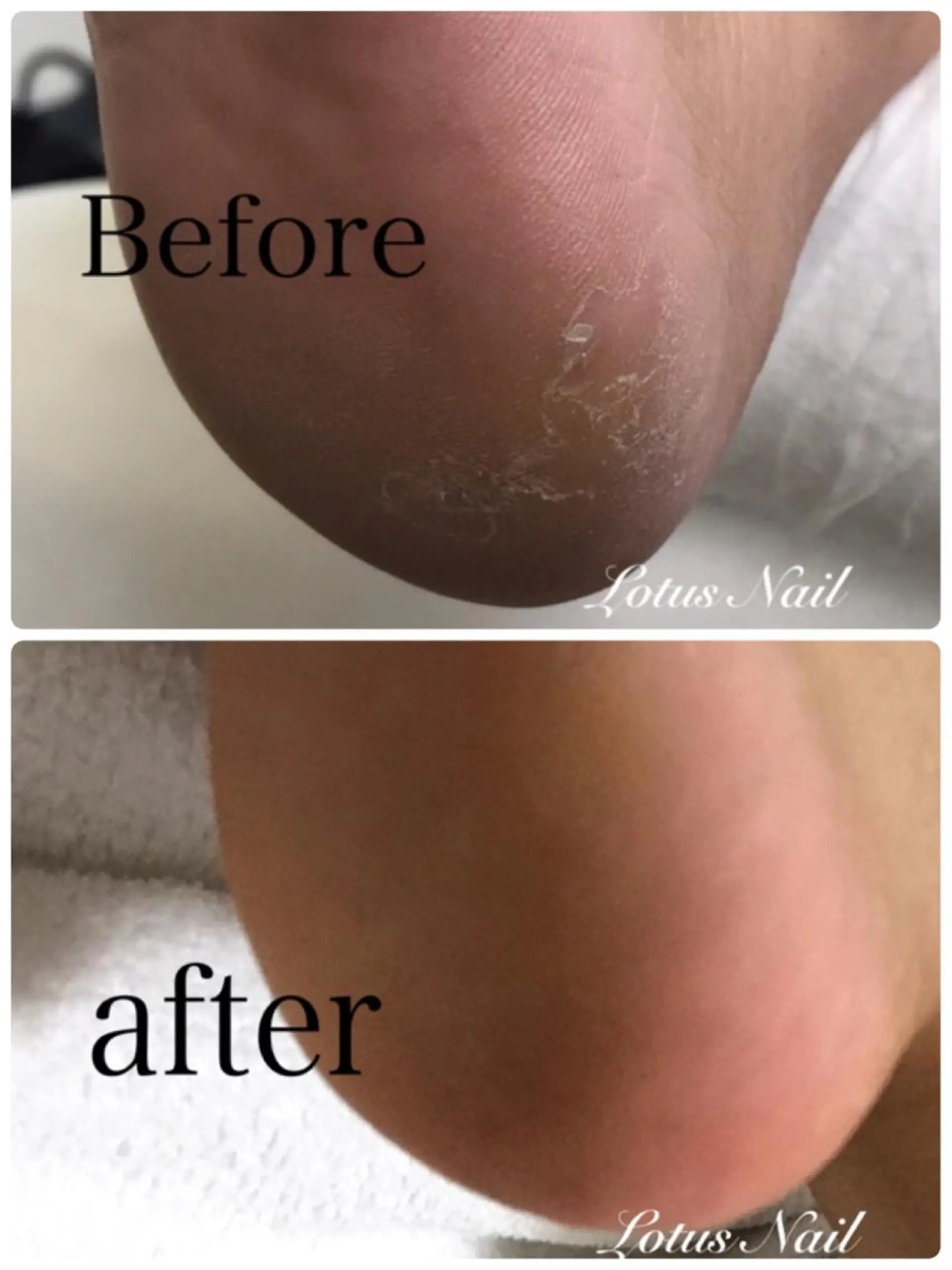 ネイル Lotus Nailのネイルデザイン