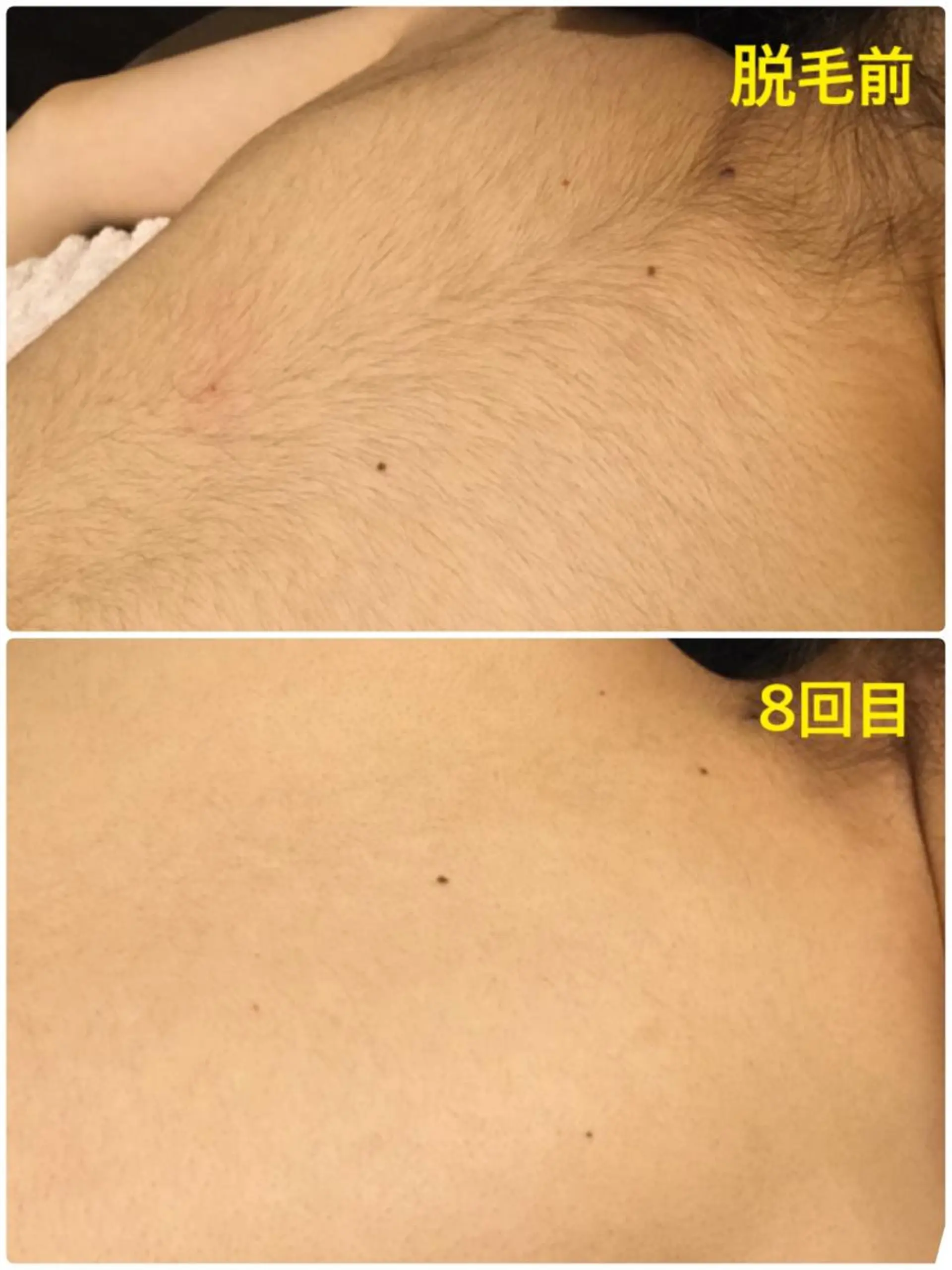 キッズ 脱毛 Dione 立川店のエステ・リラクイメージ