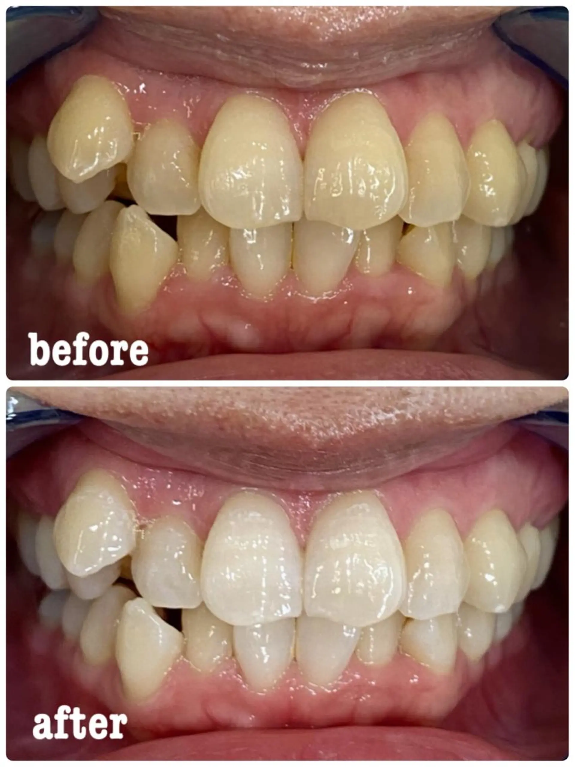 ホワイトニングサロン ラウレアのその他イメージ