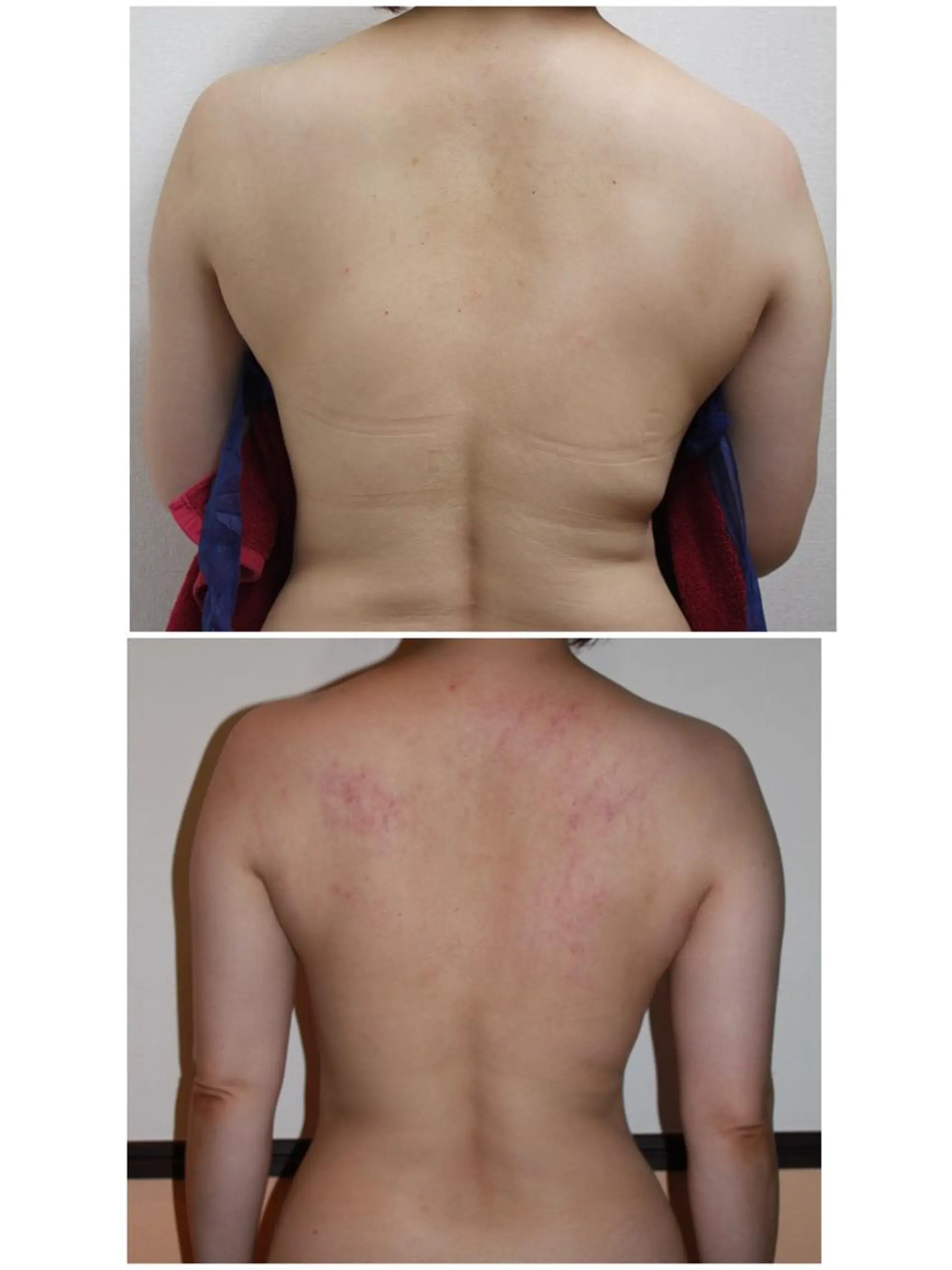 BeautySalonSoin所属・【医療提携エステ】 痩身専門Soinのエステ・リラクイメージ