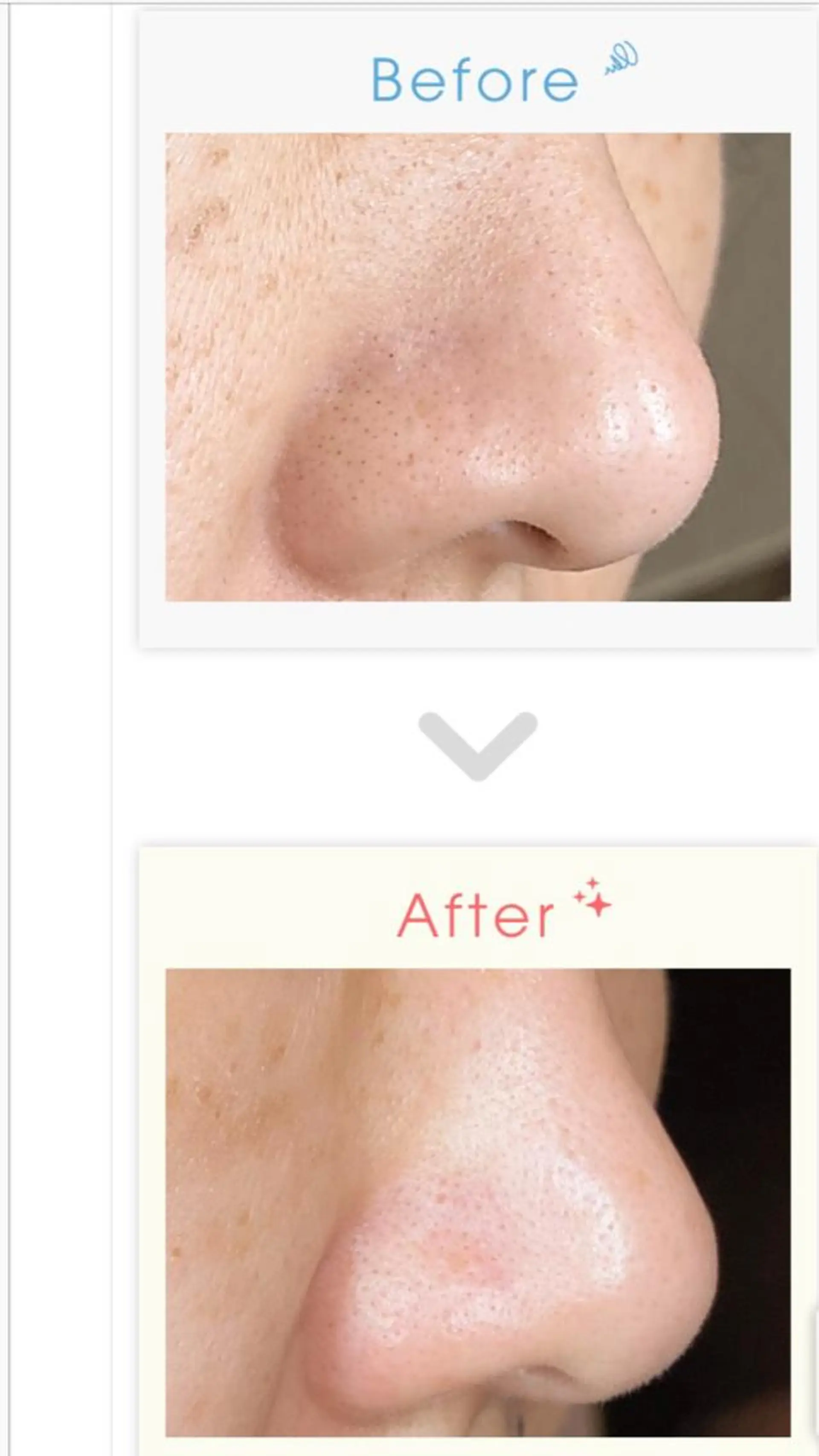 ベルーテ エッセンスのエステ・リラクイメージ