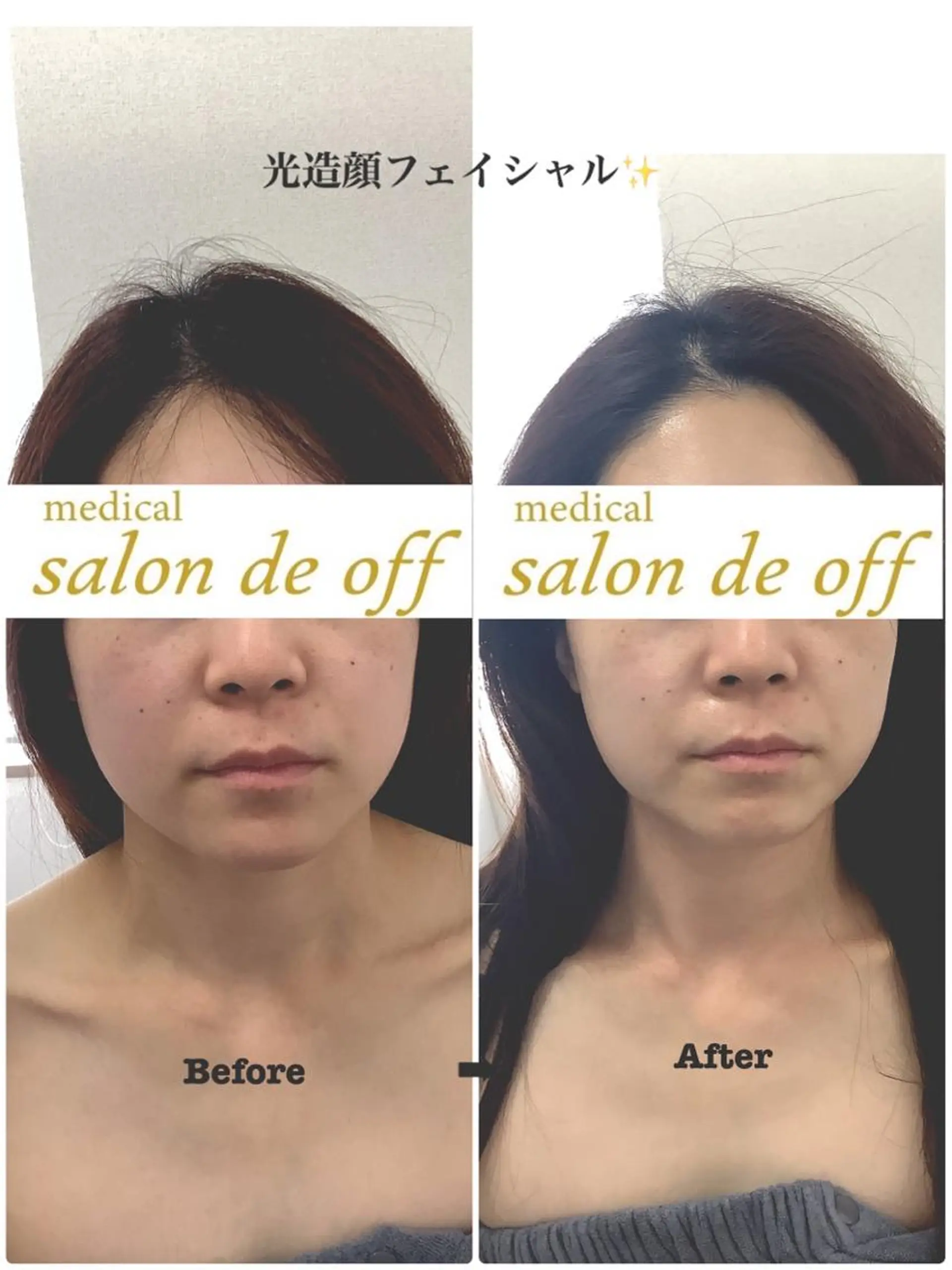 🩵Tatsumi Kana🩵のエステ・リラクイメージ