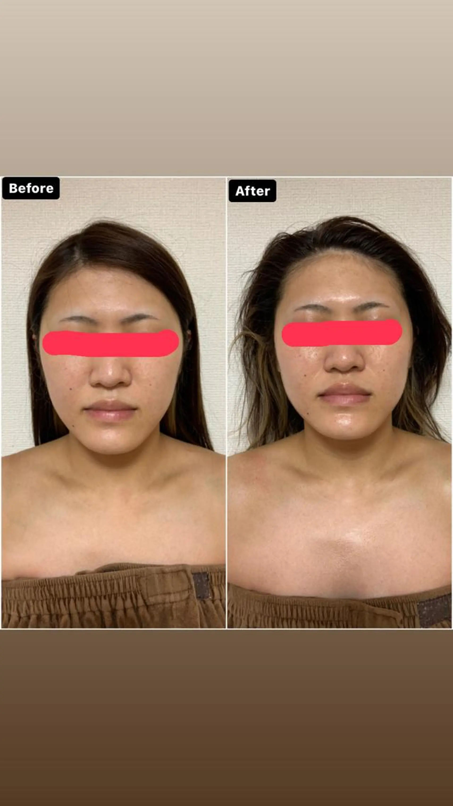 Linomalie エステ/たるみ/脱毛のエステ・リラクイメージ