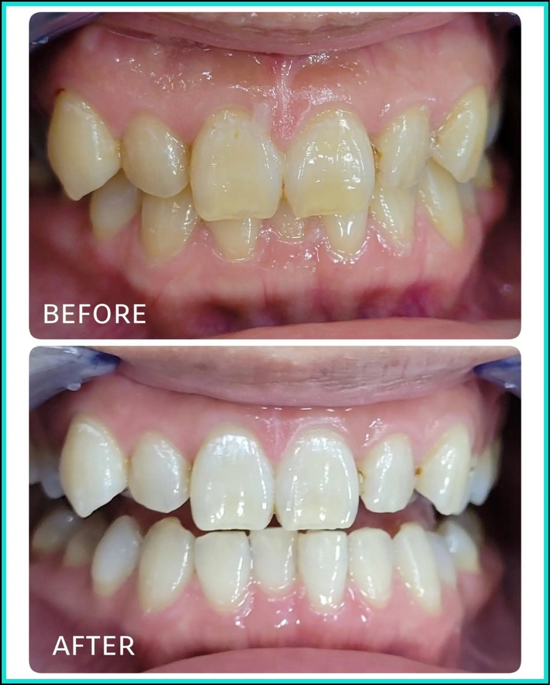 ホワイトニングサロン ラウレアのその他イメージ