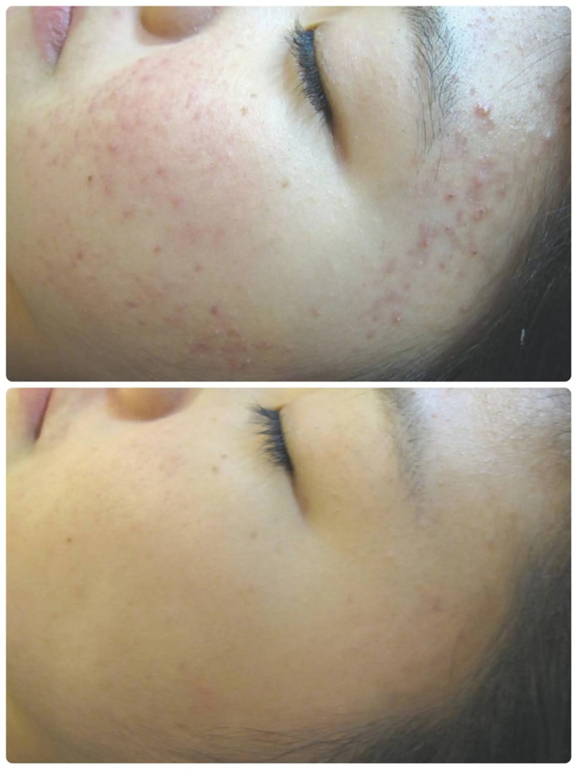 エステ 小林 理恵のエステ・リラクイメージ