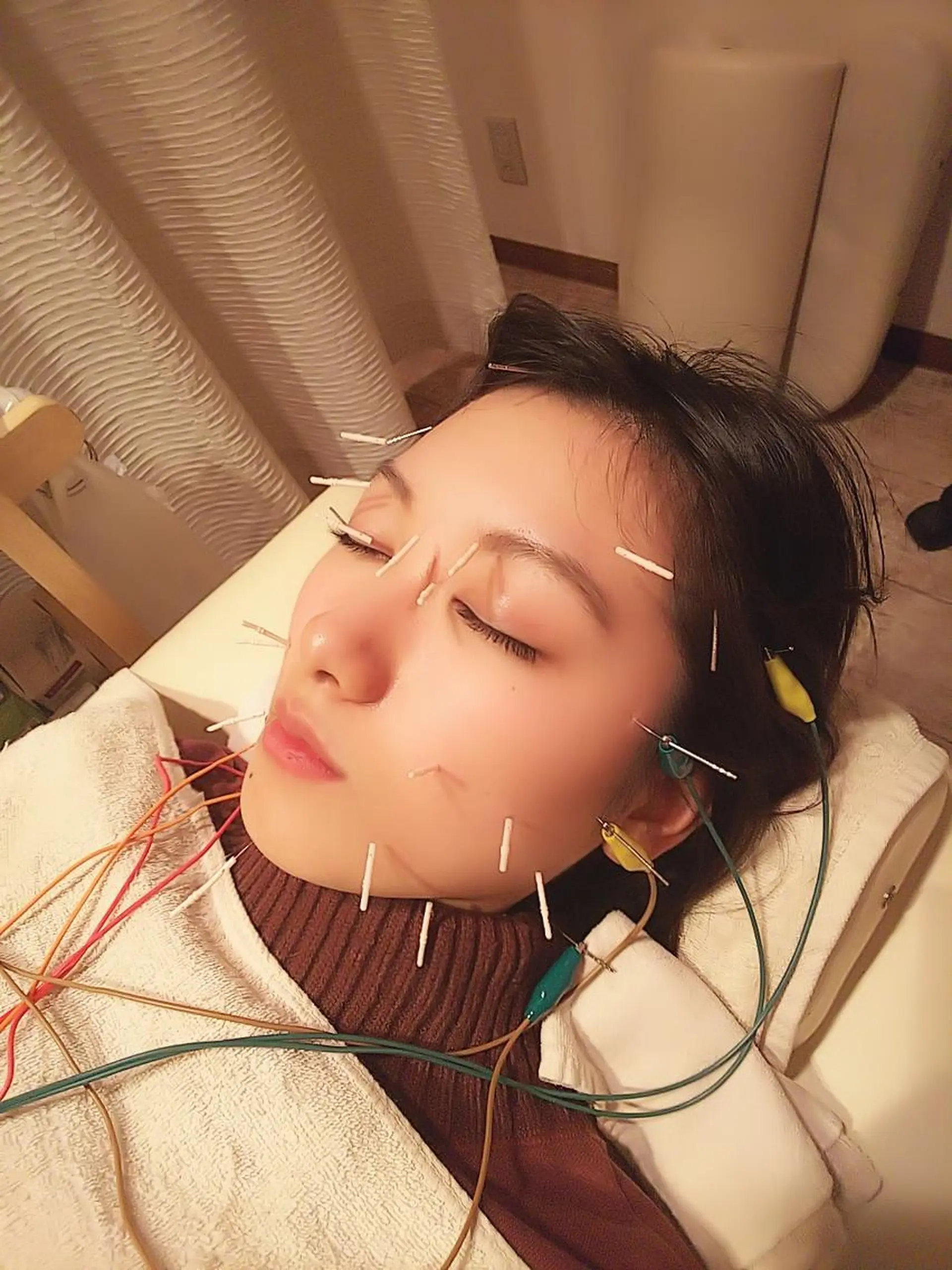 むくみたるみ専門☆ 美容鍼・小顔矯正のエステ・リラクイメージ