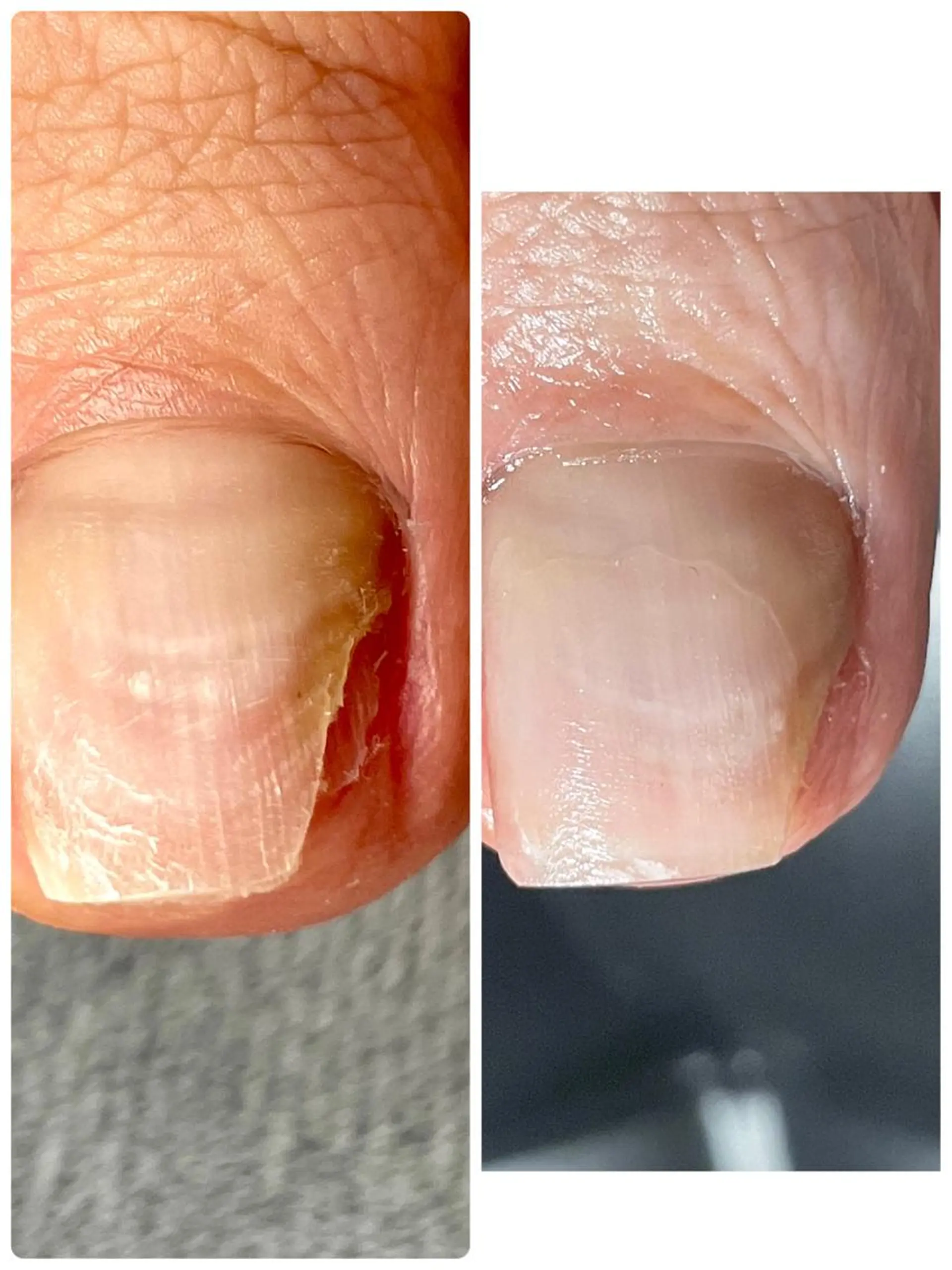 メンズ ネイル フットネイル Chérinail 爪のお手入れのネイルデザイン