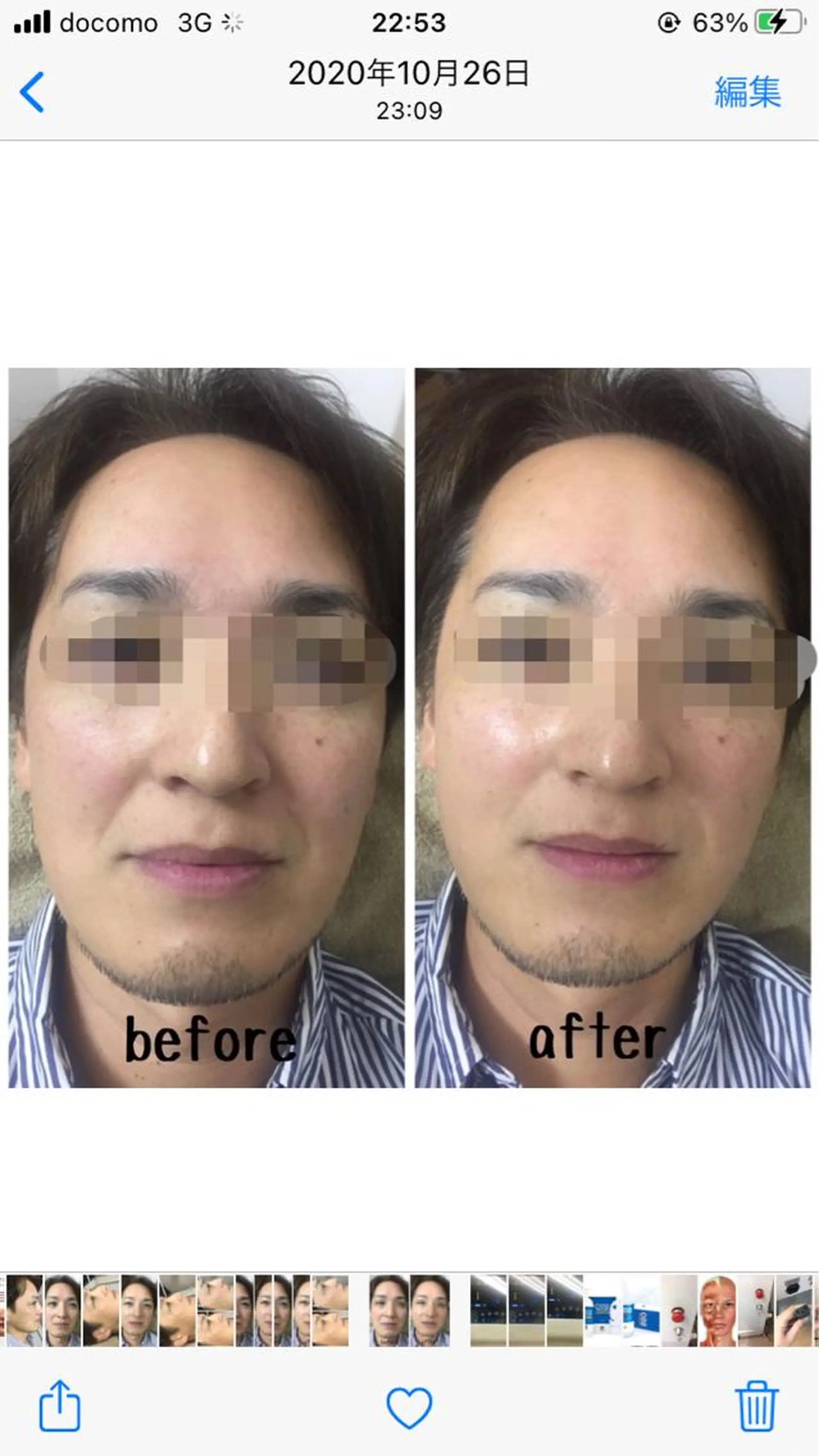 肌質改善サロン chouchouのエステ・リラクイメージ