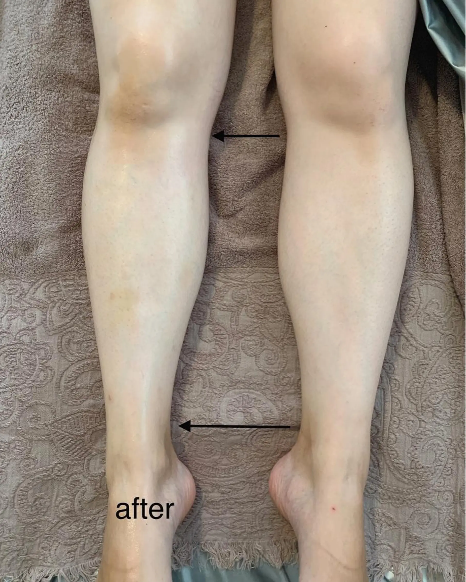 リンパとデトックス LAFUFUのその他イメージ