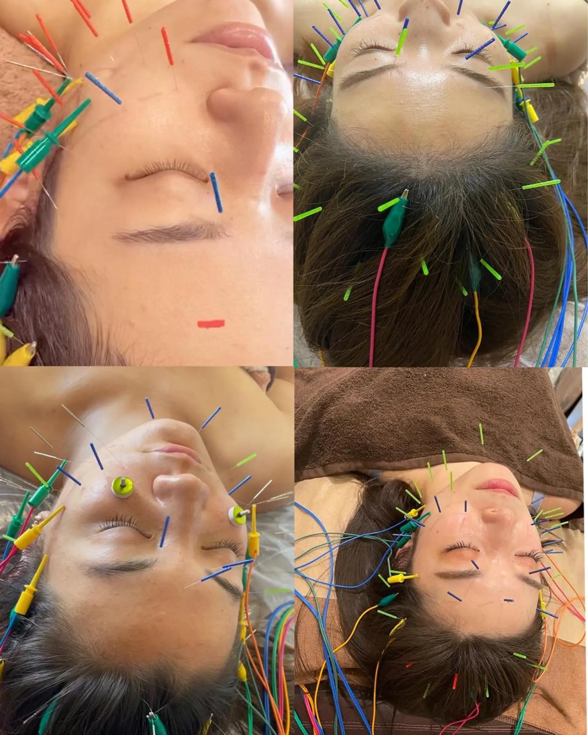 美容鍼灸サロン mahoroba院長のエステ・リラクイメージ