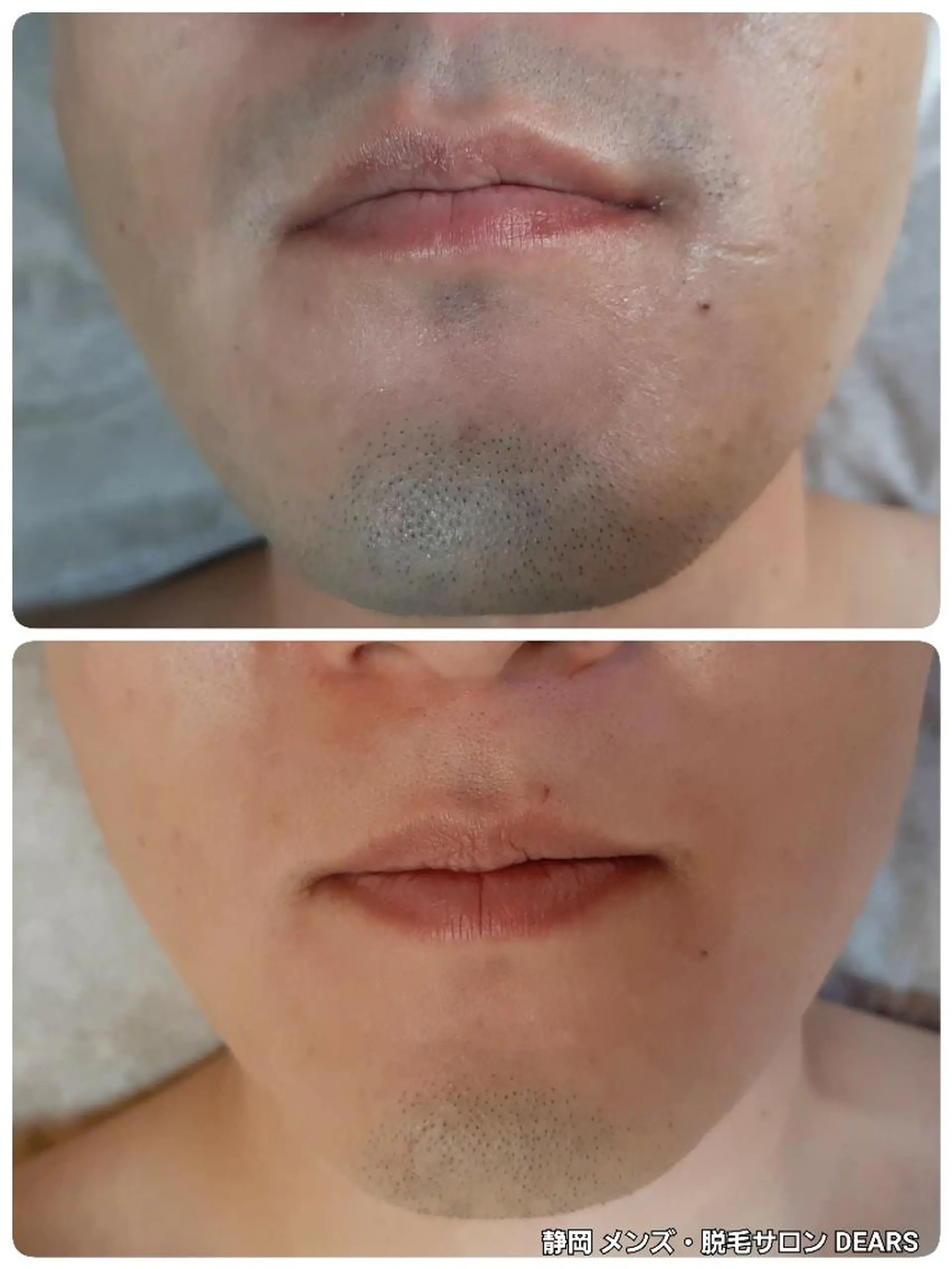 メンズ キッズ メンズ・脱毛サロン DEARS所属・山村幸久 メンズ脱毛 ディアーズのエステ・リラクイメージ