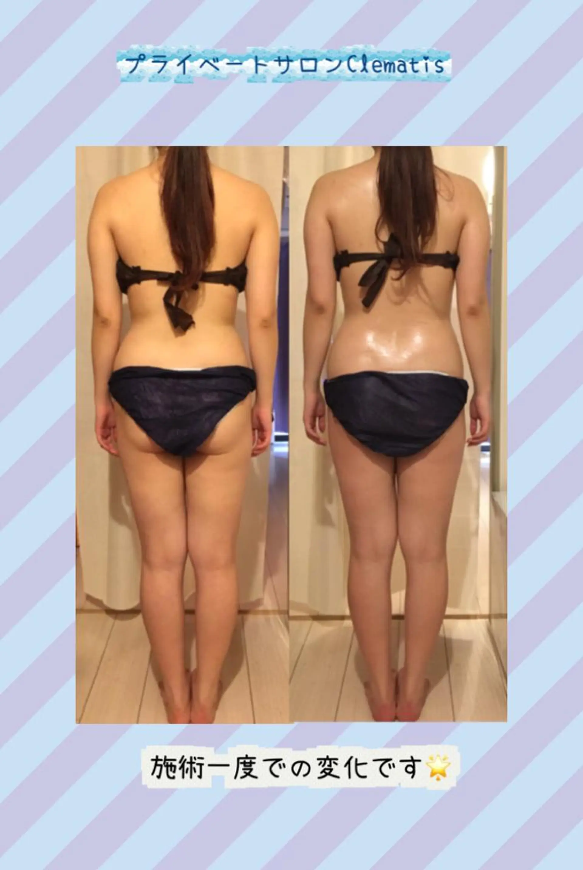 ミディアム カラー パーマ ヘアアレンジ メンズ キッズ ネイル マツエク・マツパ 強圧オールハンド痩身 片野のエステ・リラクイメージ