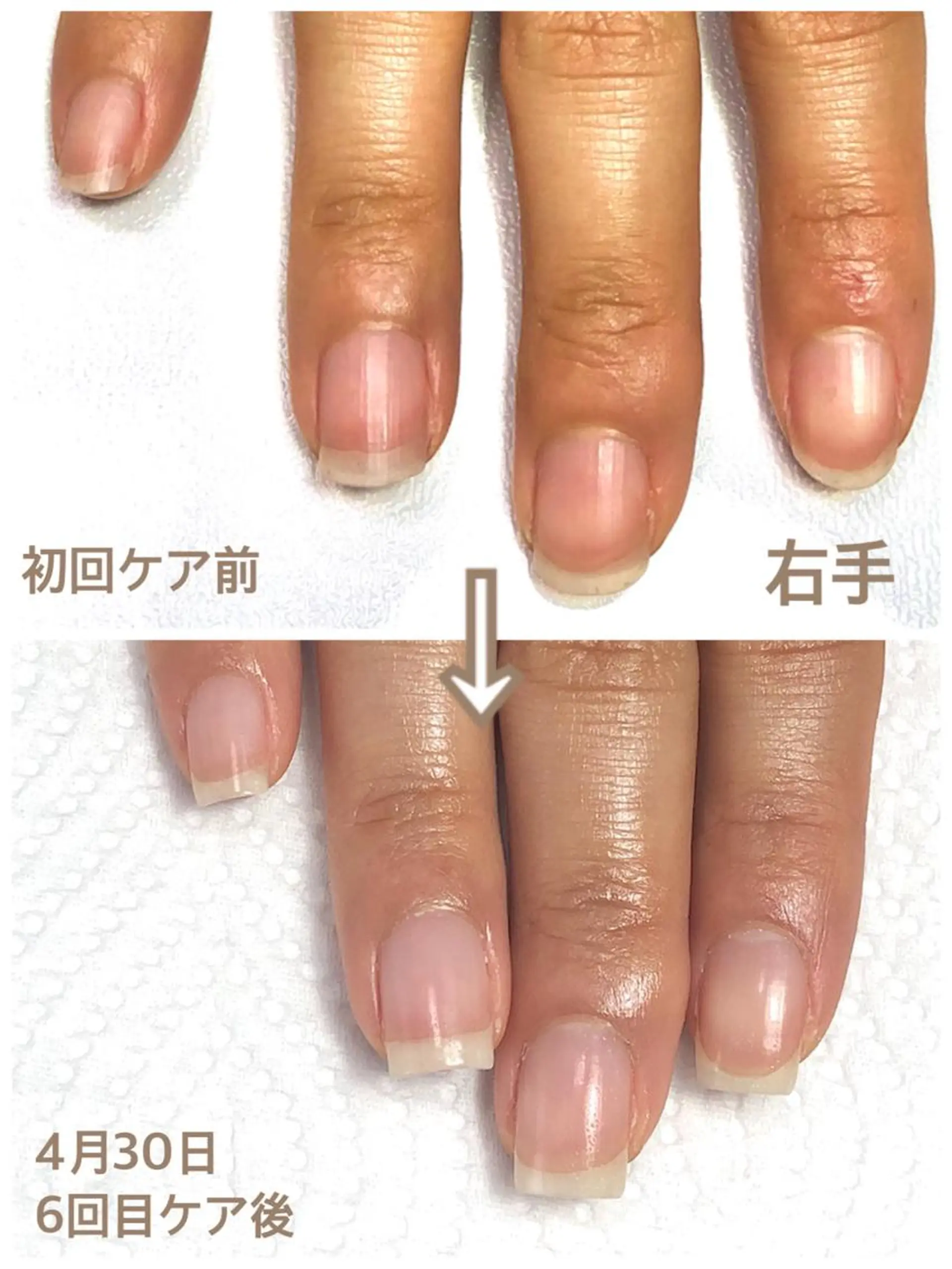 ネイル その他(ネイル) 自爪育成ネイルサロン Pause(ポーズ)のネイルデザイン