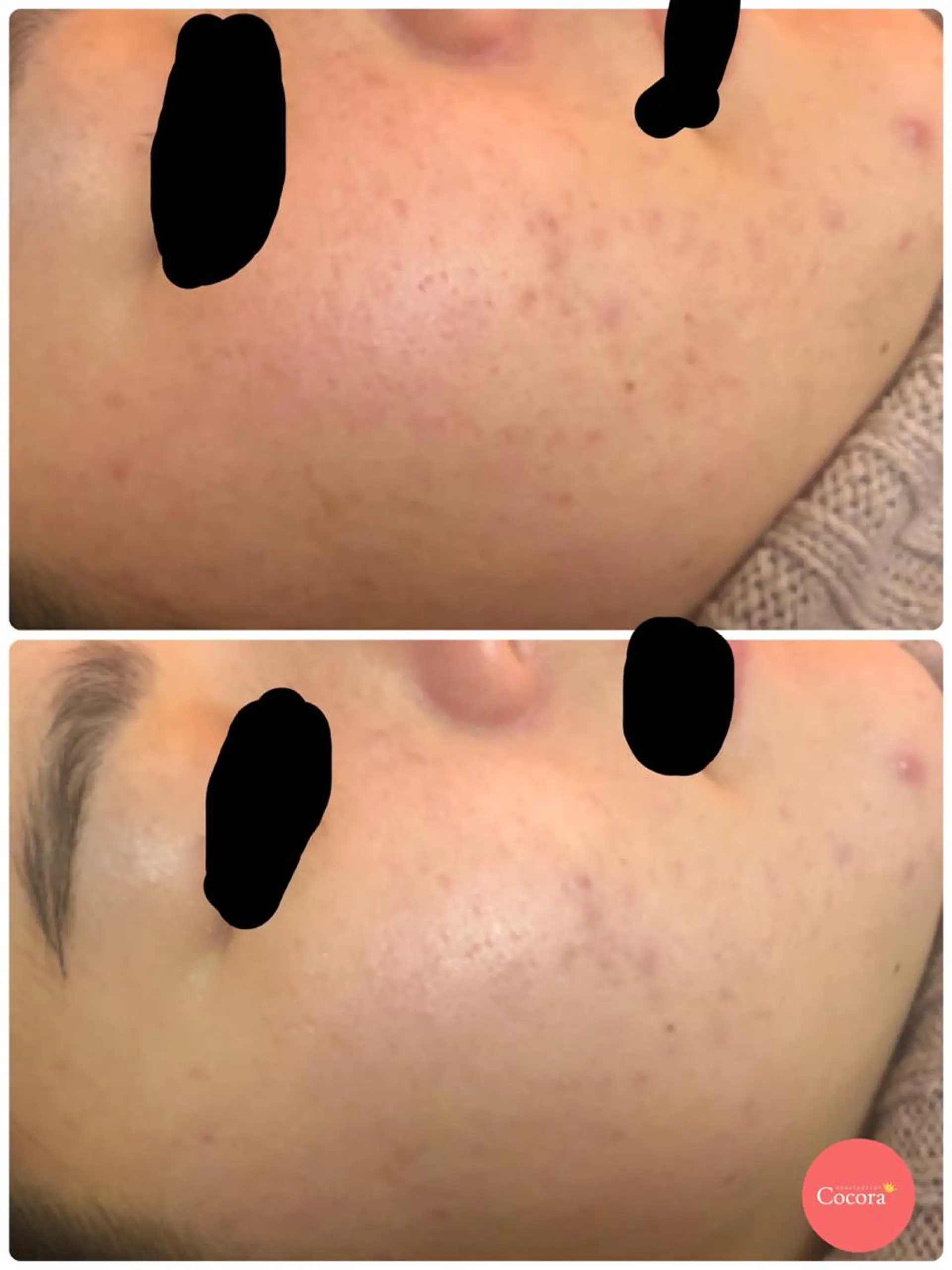 ビューティーサロン ココラのマツエク・マツパデザイン