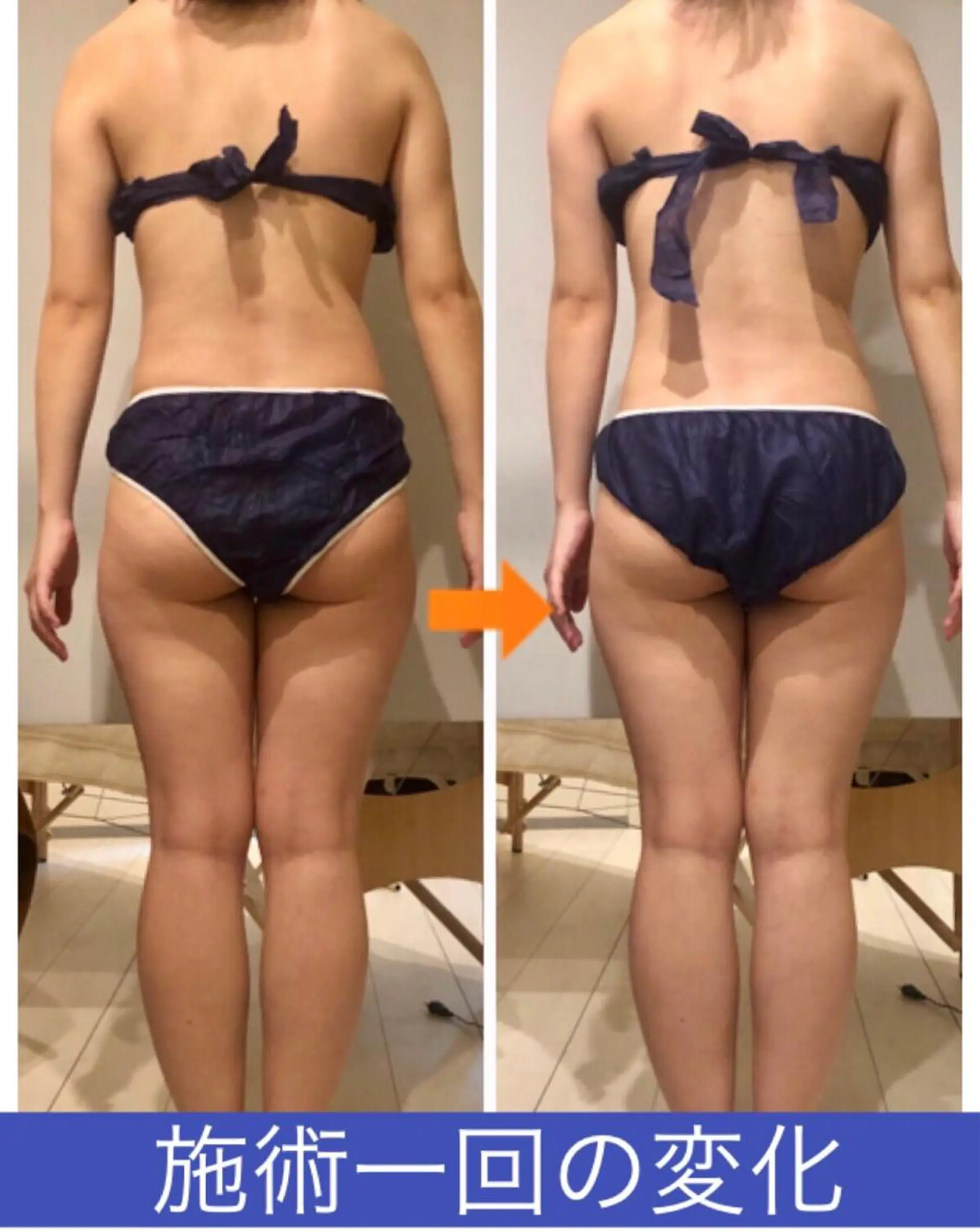 ショート カラー パーマ ヘアアレンジ メンズ キッズ ネイル マツエク・マツパ ‍痩身＆ボディ 結果出し🌟丹野のエステ・リラクイメージ