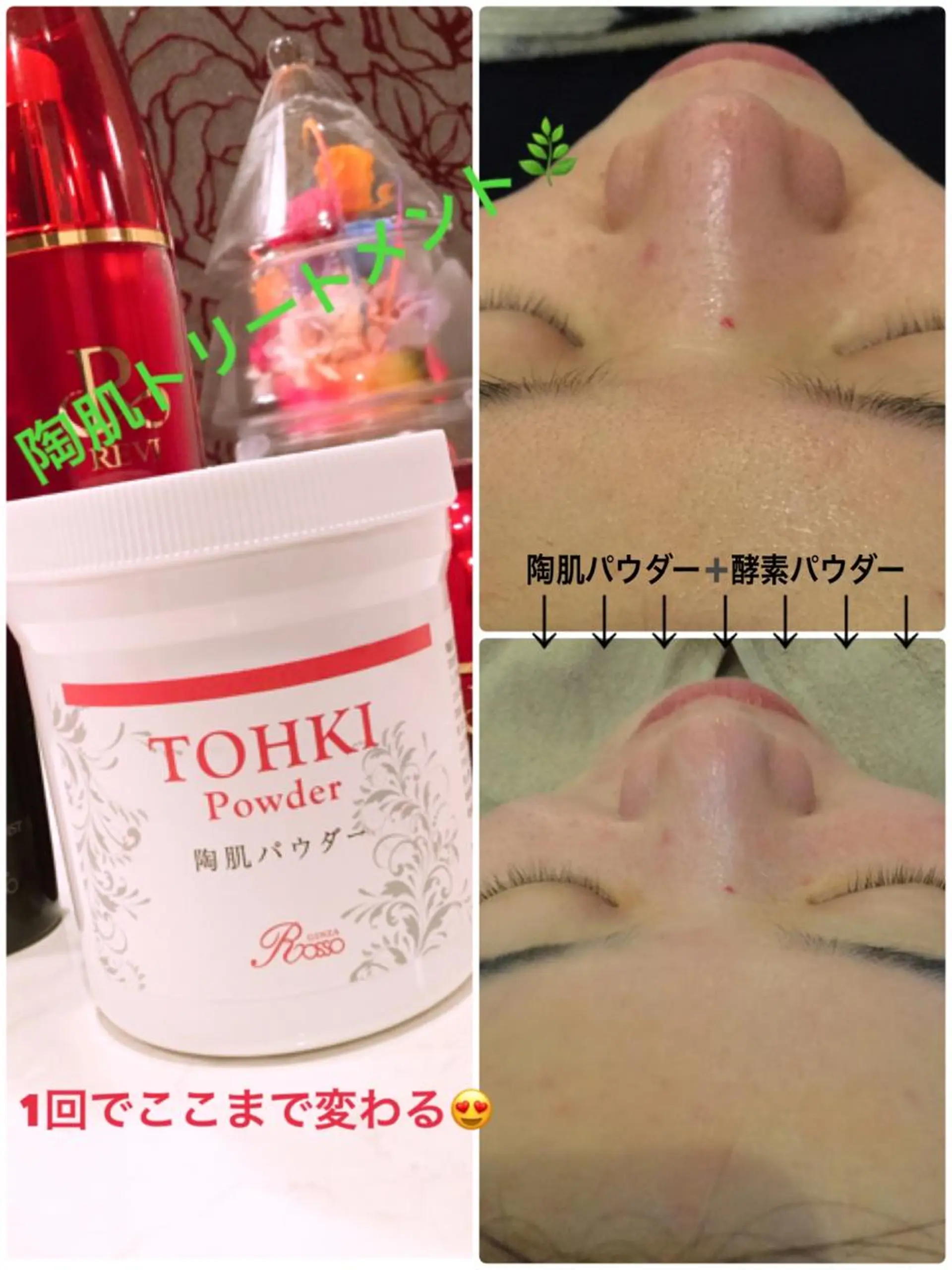 エステ 【リベルハーブピーリング認定店】敏感肌・美白脱毛専門店Dione立川店所属・Dione 立川店のエステ・リラクイメージ