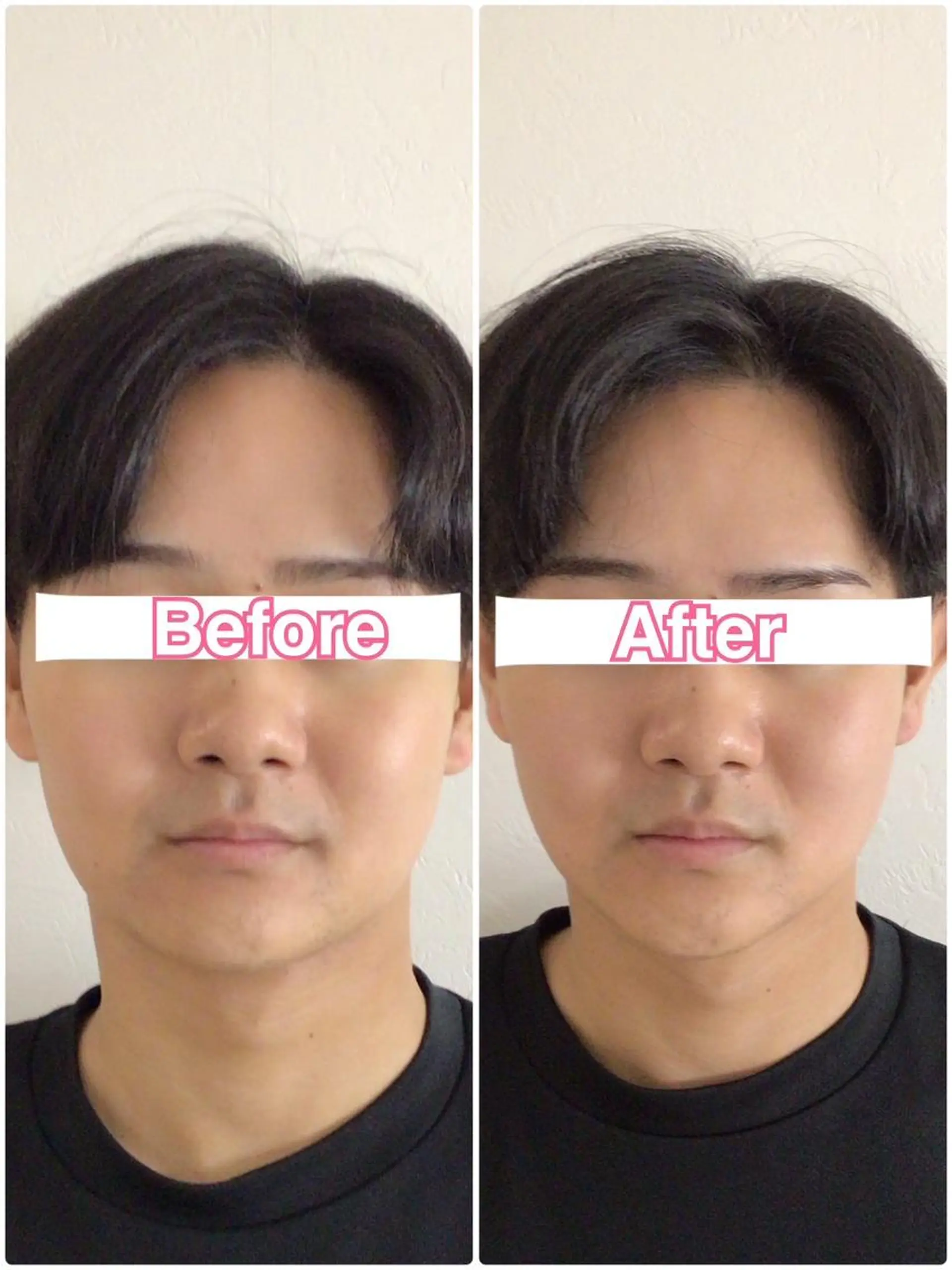 エステ リラク 美容鍼・整体サロン アネモネ🌸心斎橋のエステ・リラクイメージ