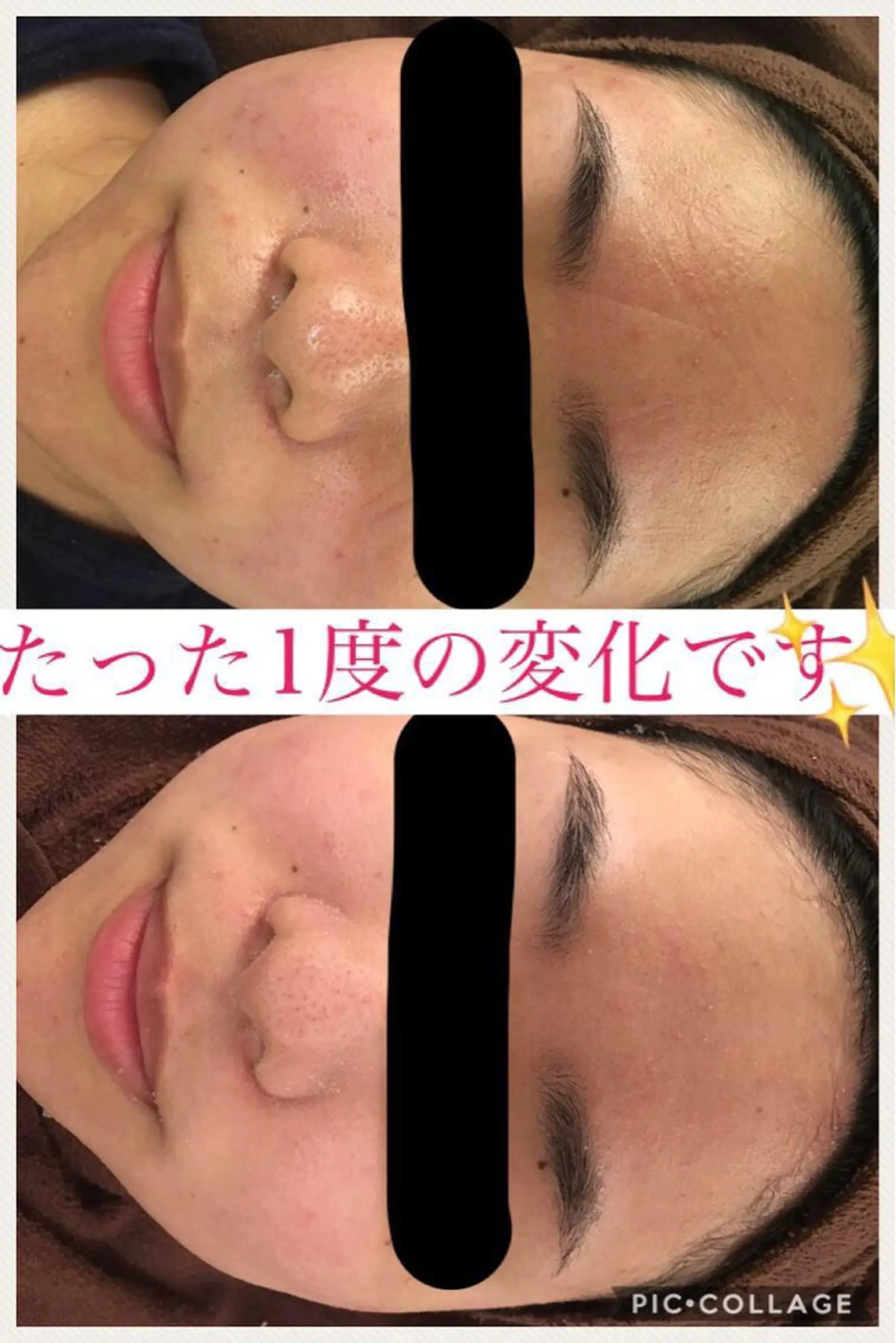 ショート カラー パーマ ヘアアレンジ メンズ キッズ ネイル マツエク・マツパ ニキビ・肌質改善専門 ♡人生が変わるサロンのエステ・リラクイメージ