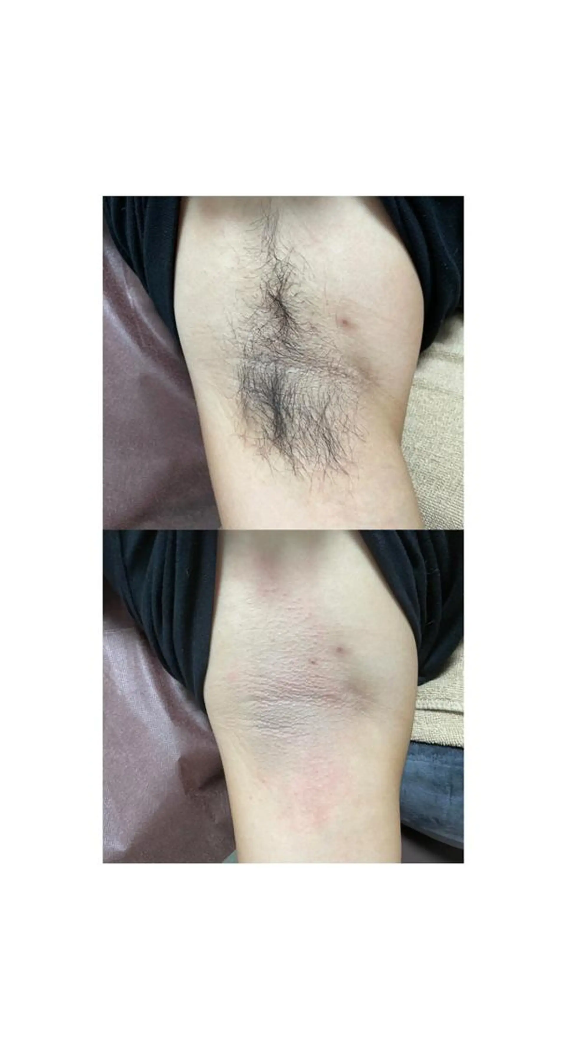 メンズ 脱毛 Epina 千葉店 【エピナ】のエステ・リラクイメージ