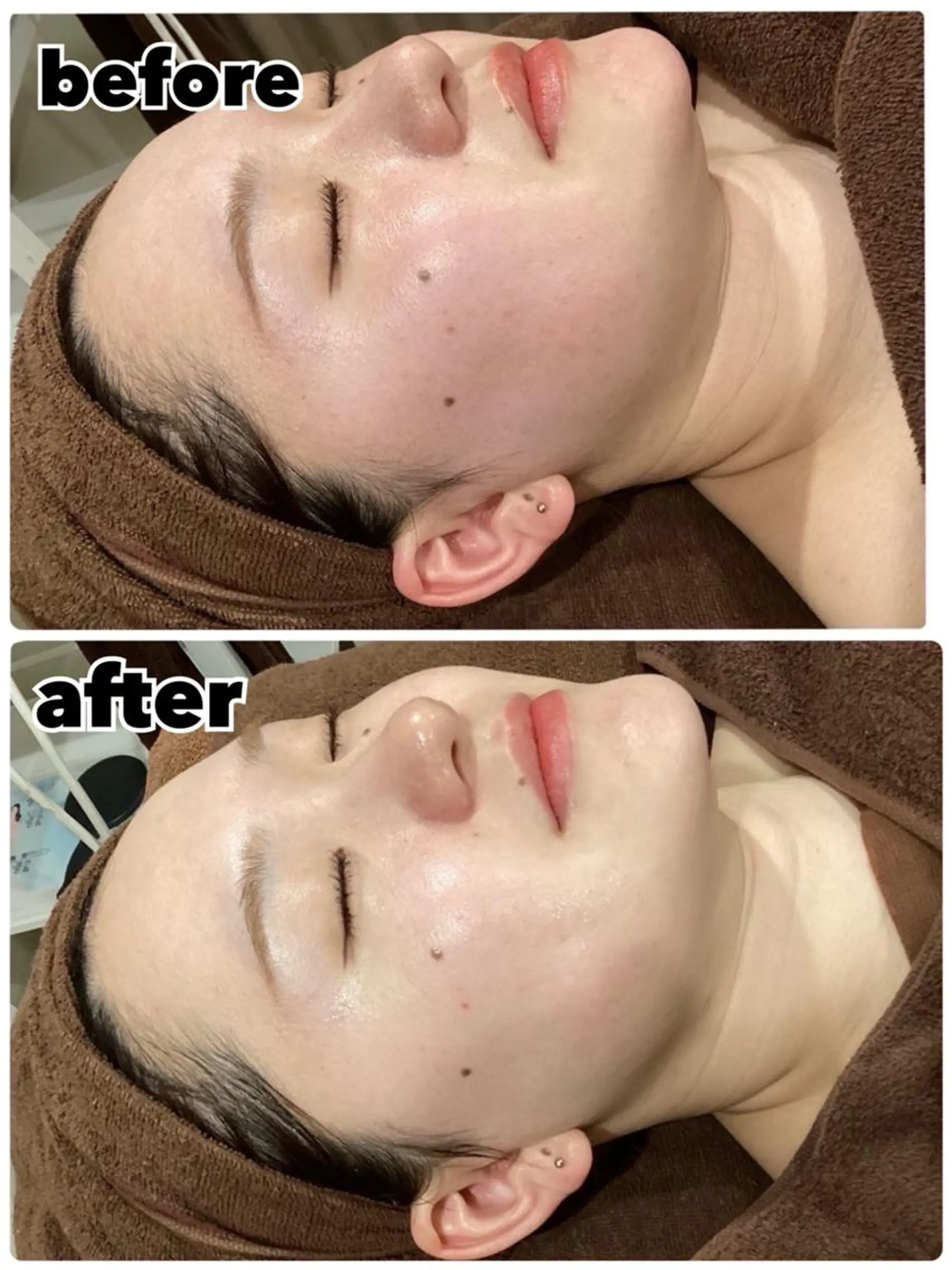 エステ レイビス 渋谷店中野🤍のエステ・リラクイメージ