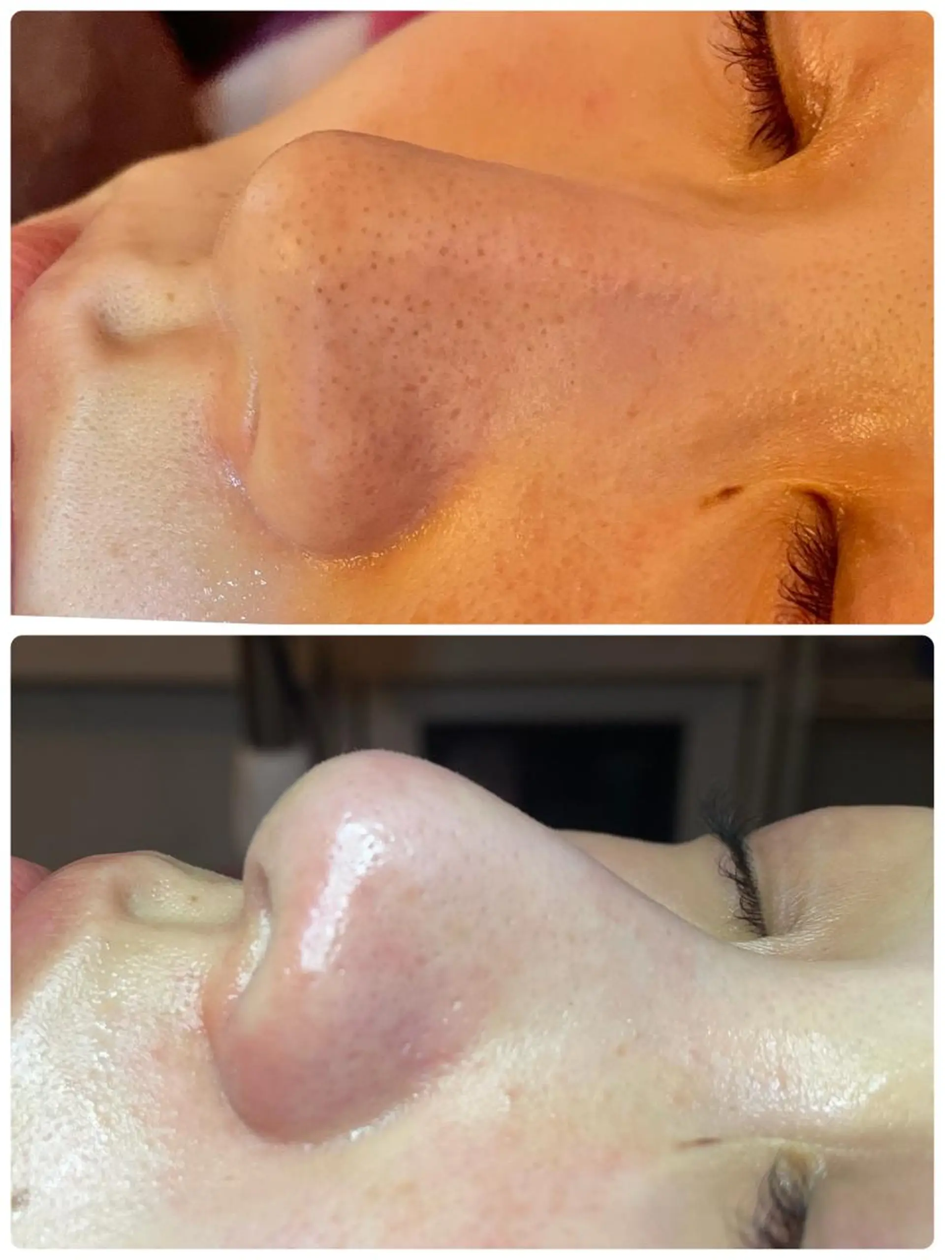 松下 千恵のネイルデザイン