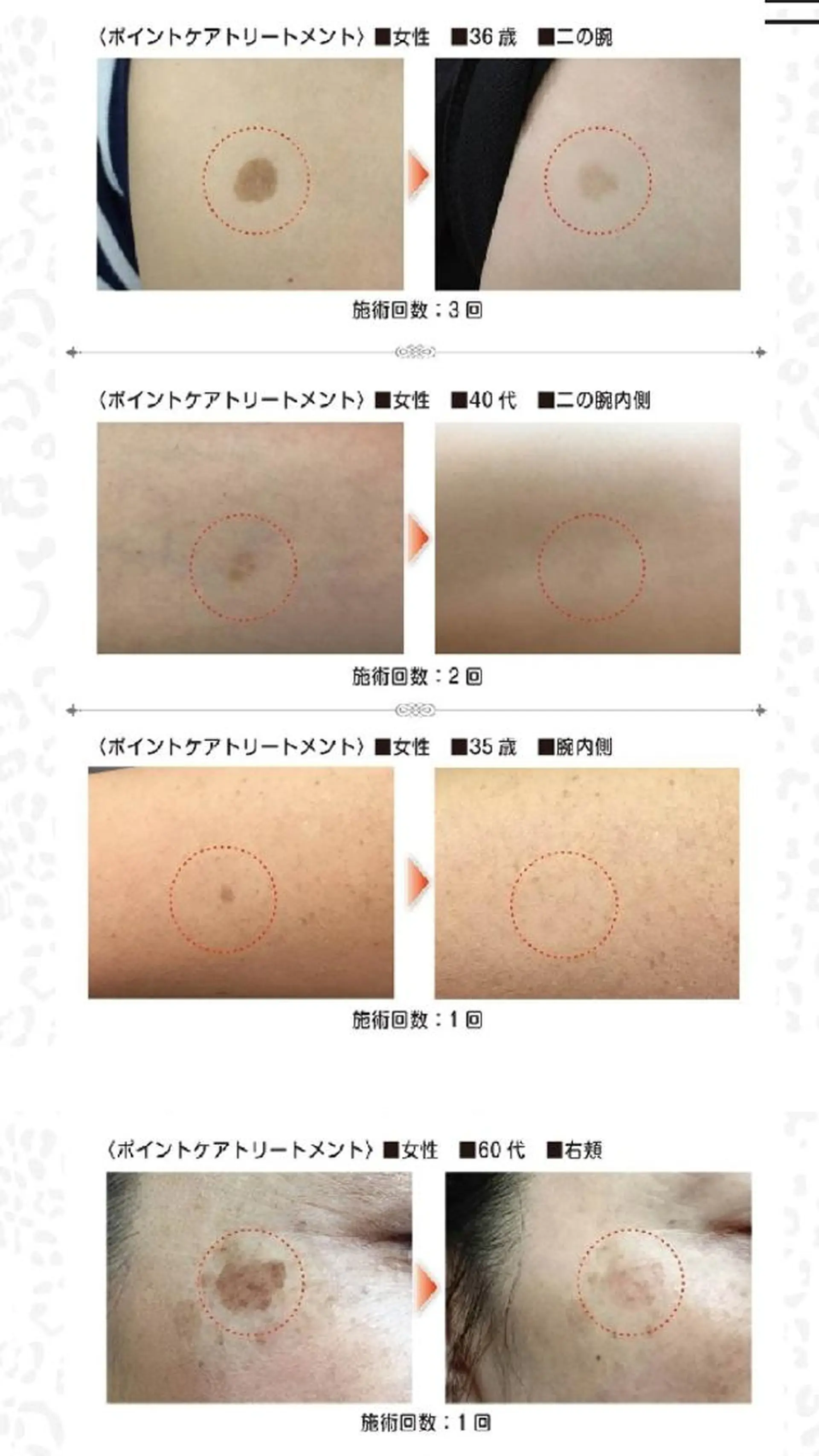 🅖🅤🅩🅔🅛 salonのエステ・リラクイメージ