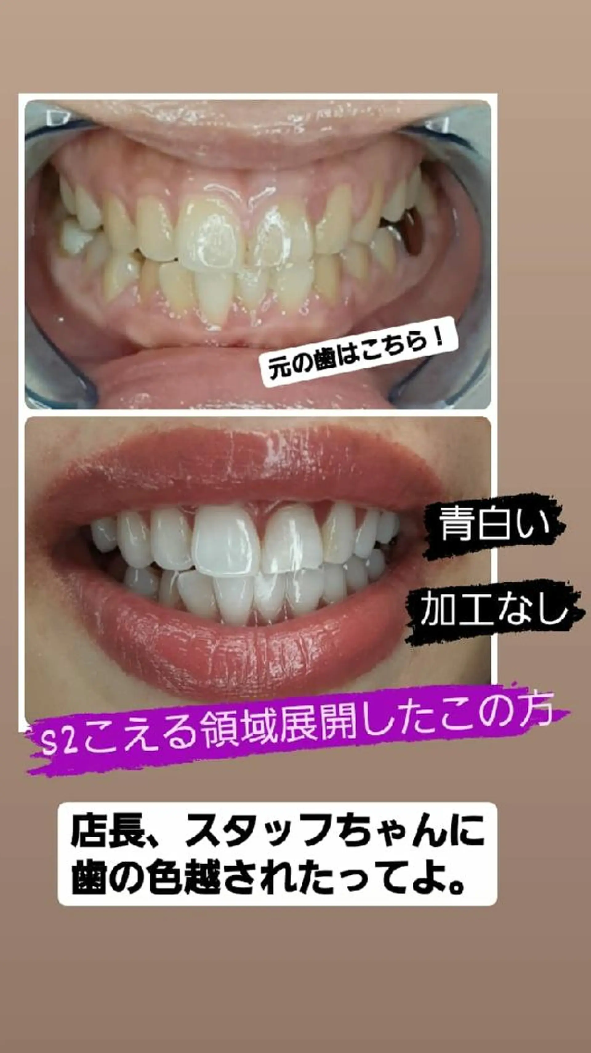 五十嵐 蓮のその他イメージ