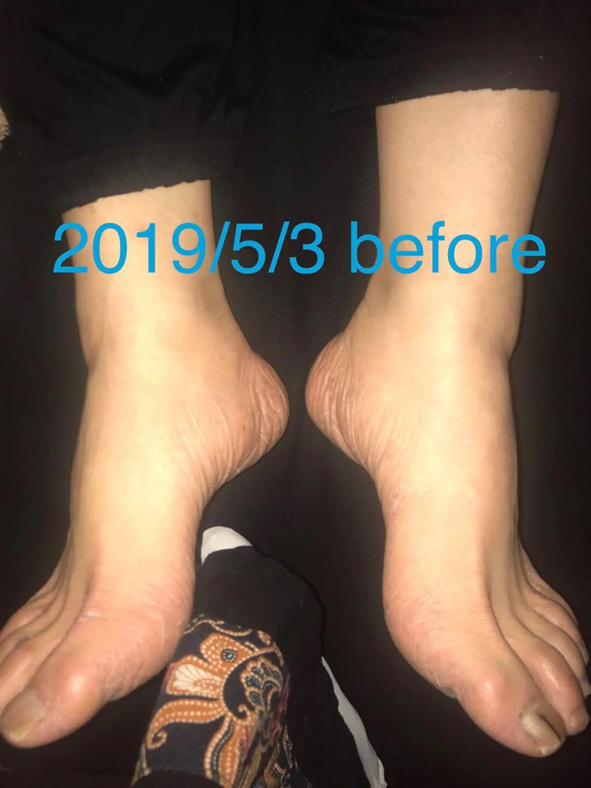 リラク 【足圧】鬼👹リンパ 身体整うサロンのエステ・リラクイメージ