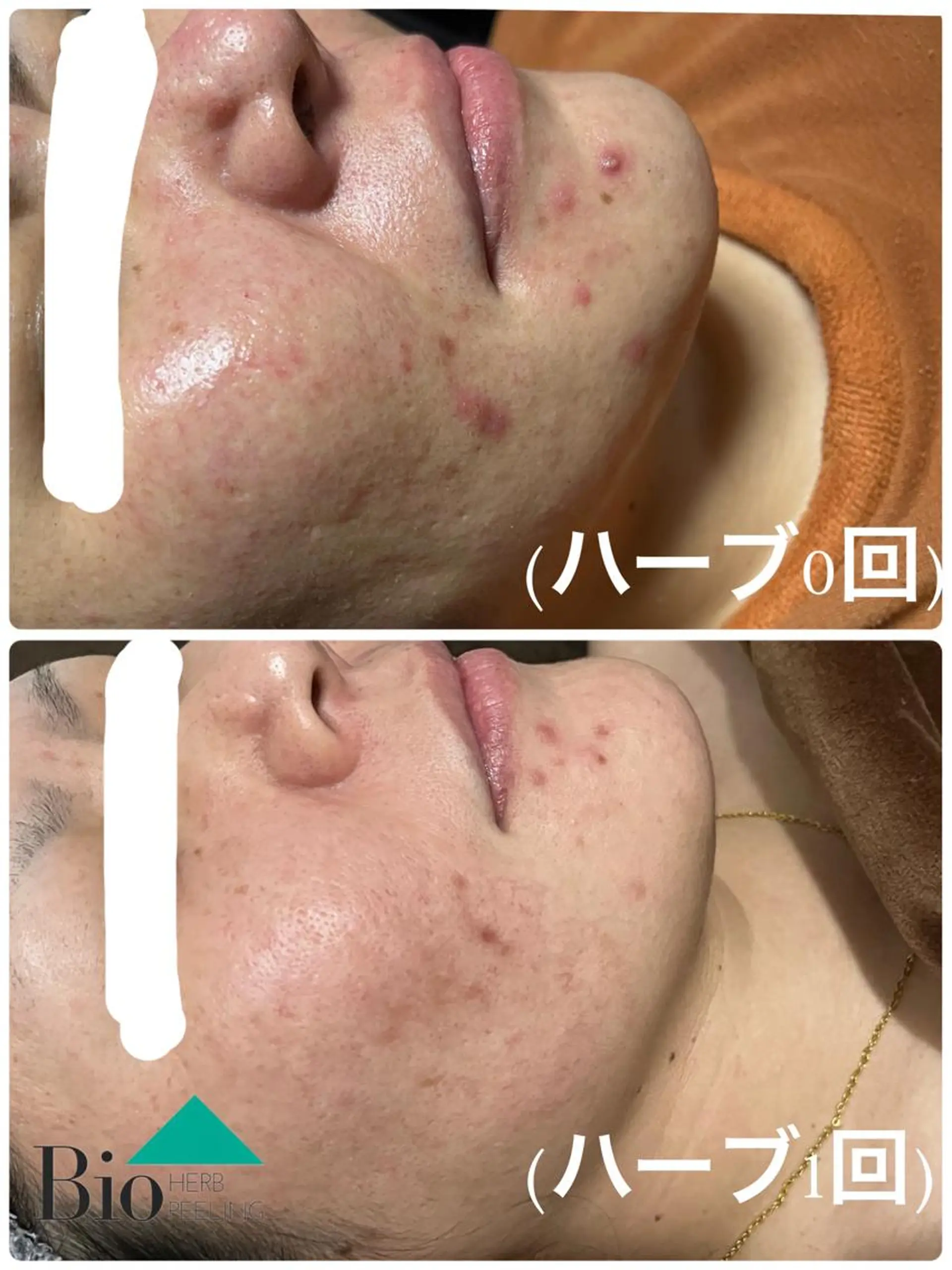 SALON BioBioのエステ・リラクイメージ