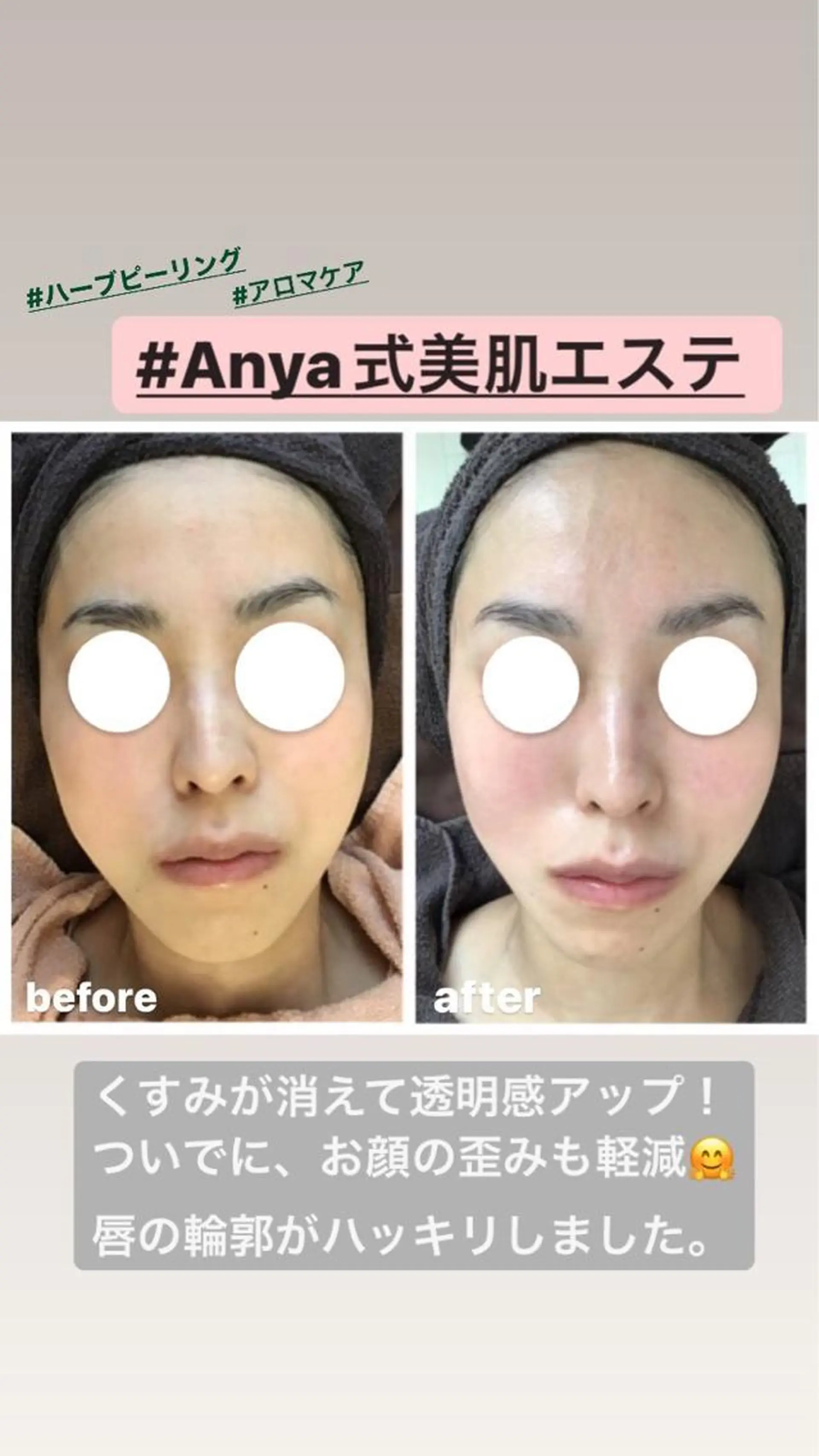 エステ リラク Anya Beautyのエステ・リラクイメージ