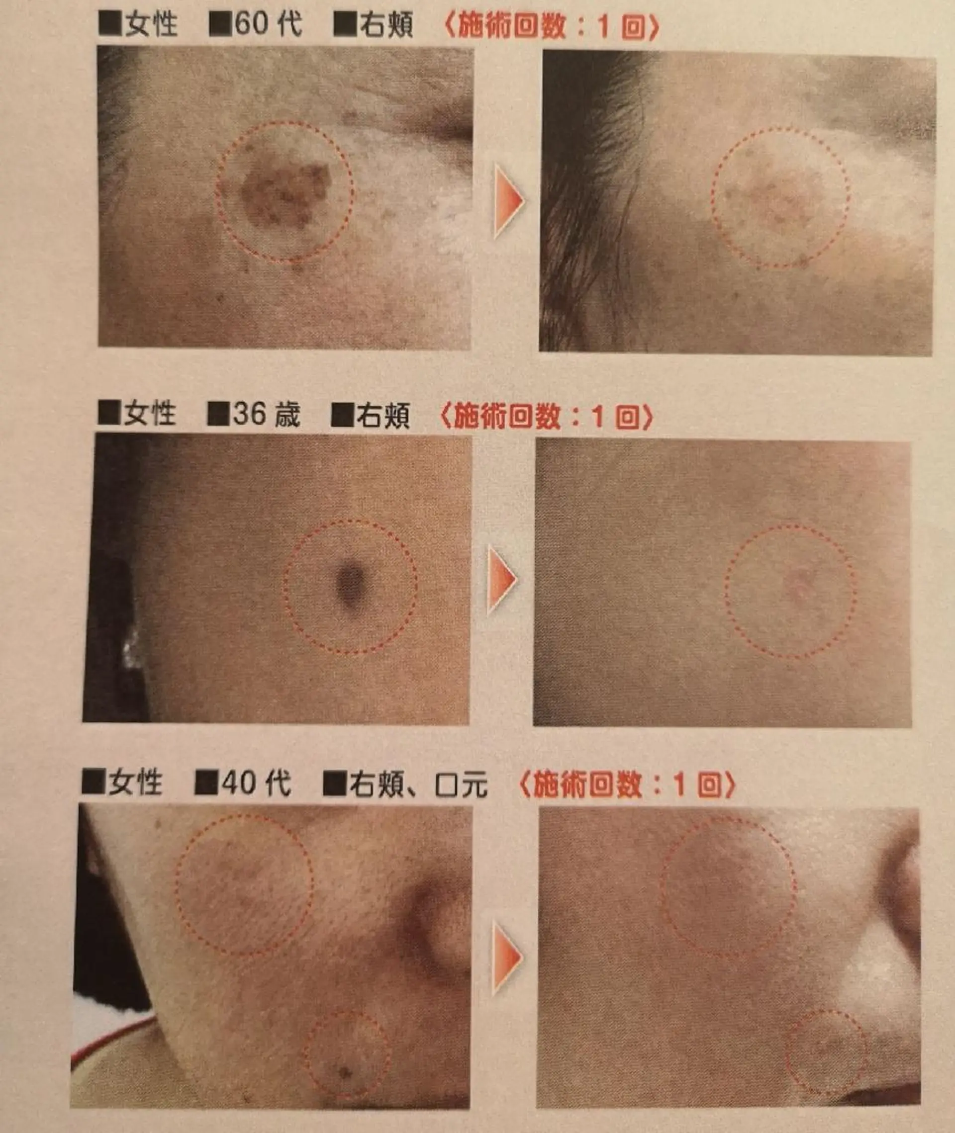 🅖🅤🅩🅔🅛 salonのエステ・リラクイメージ