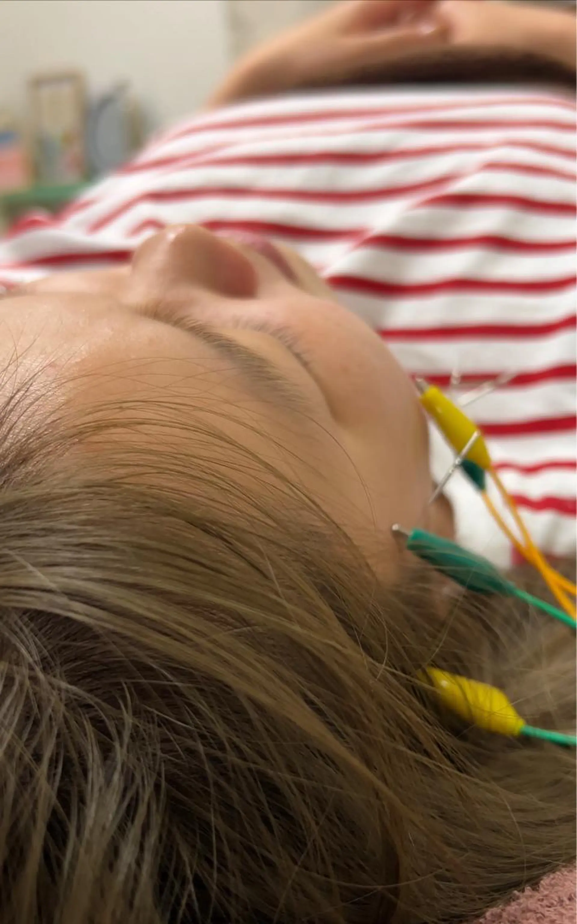 武庫之荘ひなた 鍼灸院のエステ・リラクイメージ