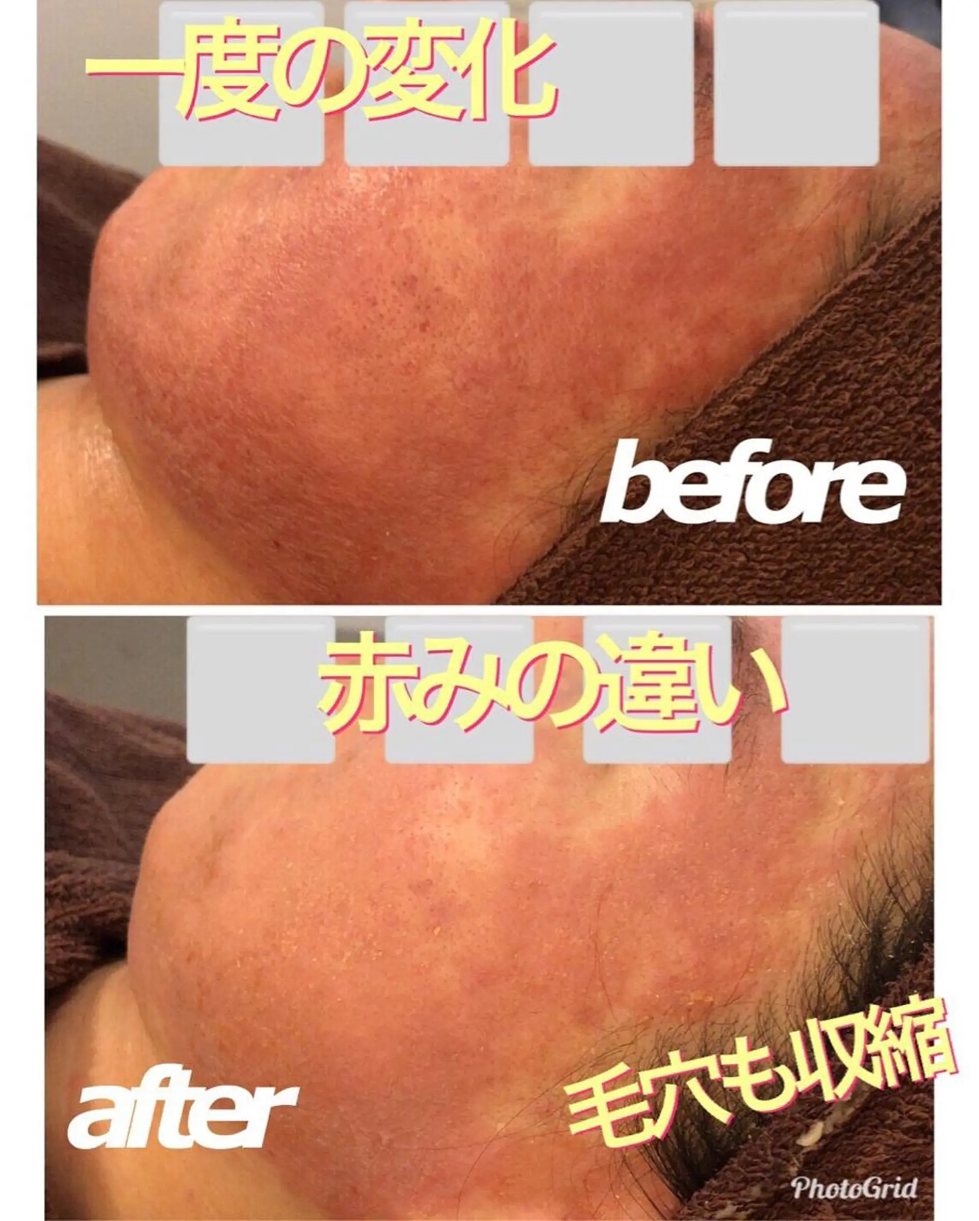 ミディアム カラー パーマ ヘアアレンジ メンズ キッズ ネイル 金の糸脱毛 産毛ケア専門のエステ・リラクイメージ