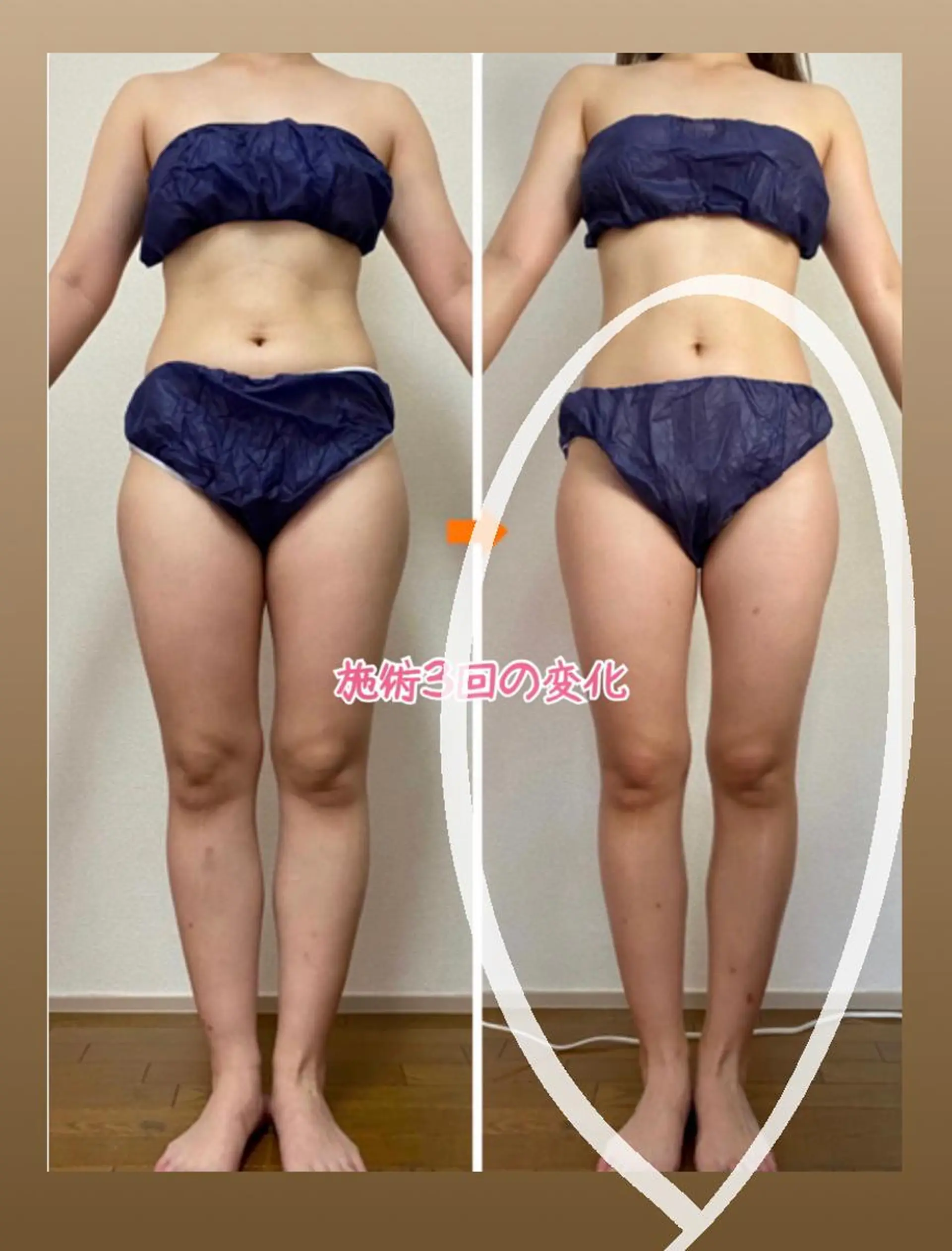 ショート カラー パーマ ヘアアレンジ メンズ キッズ ネイル マツエク・マツパ ‍痩身＆ボディ 結果出し🌟丹野のエステ・リラクイメージ