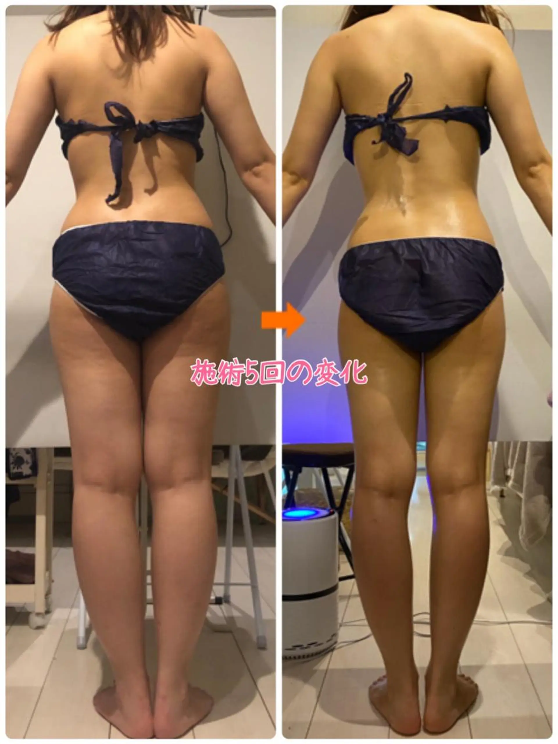 ショート カラー パーマ ヘアアレンジ メンズ キッズ ネイル マツエク・マツパ エステ リラク ‍痩身＆ボディ 結果出し🌟丹野のエステ・リラクイメージ