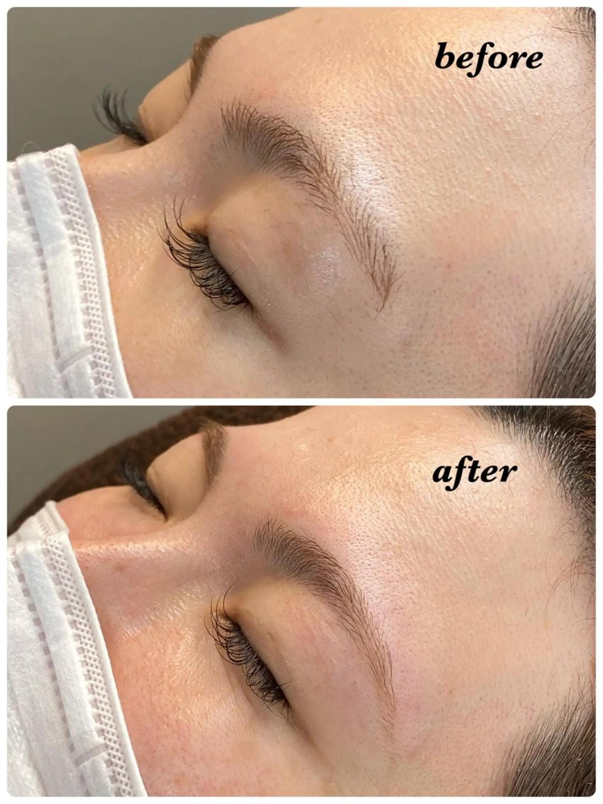 アイブロウ ハーブピーリング/韓国肌管理/フェイシャル/毛穴洗浄/眉毛/顔脱毛【糸脱毛専門】rev所属・ハーブピーリング専門 毛穴洗浄❤️眉waxのエステ・リラクイメージ