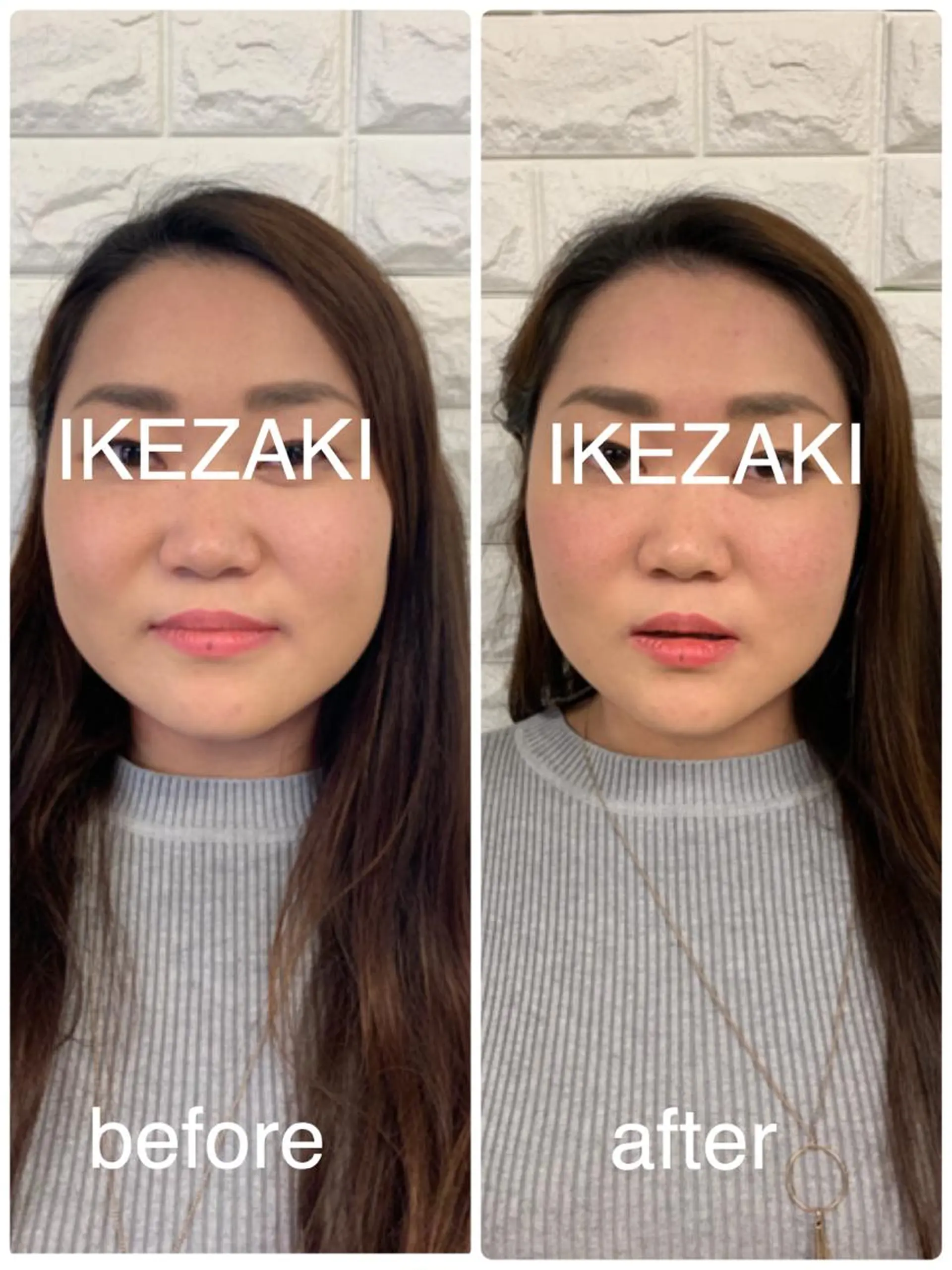 美容鍼 IKEZAKIのエステ・リラクイメージ