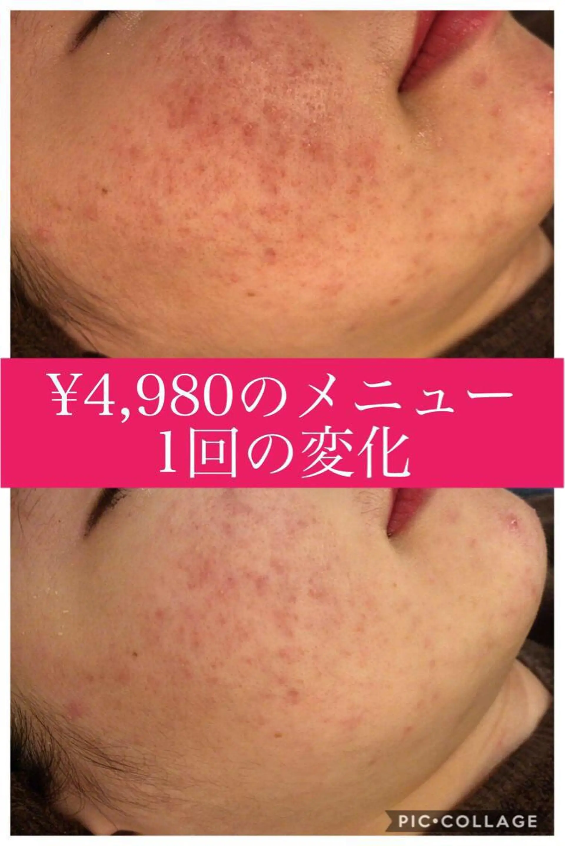 ショート カラー パーマ ヘアアレンジ メンズ キッズ ネイル マツエク・マツパ ニキビ・肌質改善専門 ♡人生が変わるサロンのエステ・リラクイメージ