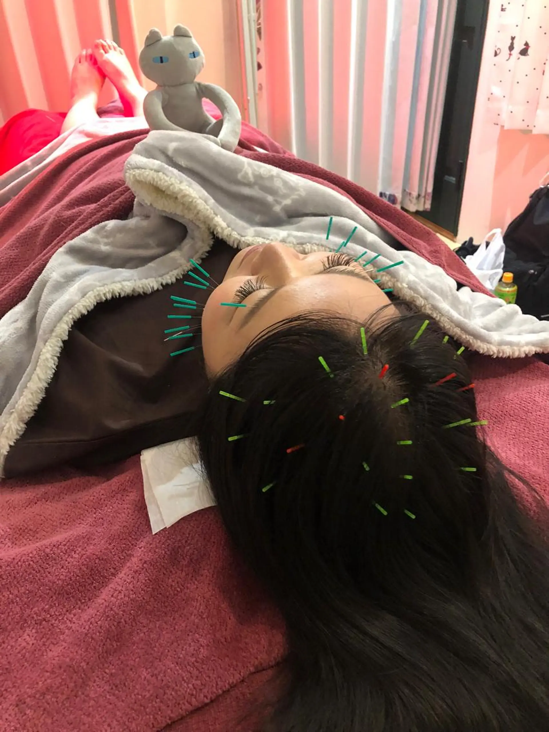 エステ リラク 美容鍼灸女性専用 りんご鍼灸治療院のその他イメージ