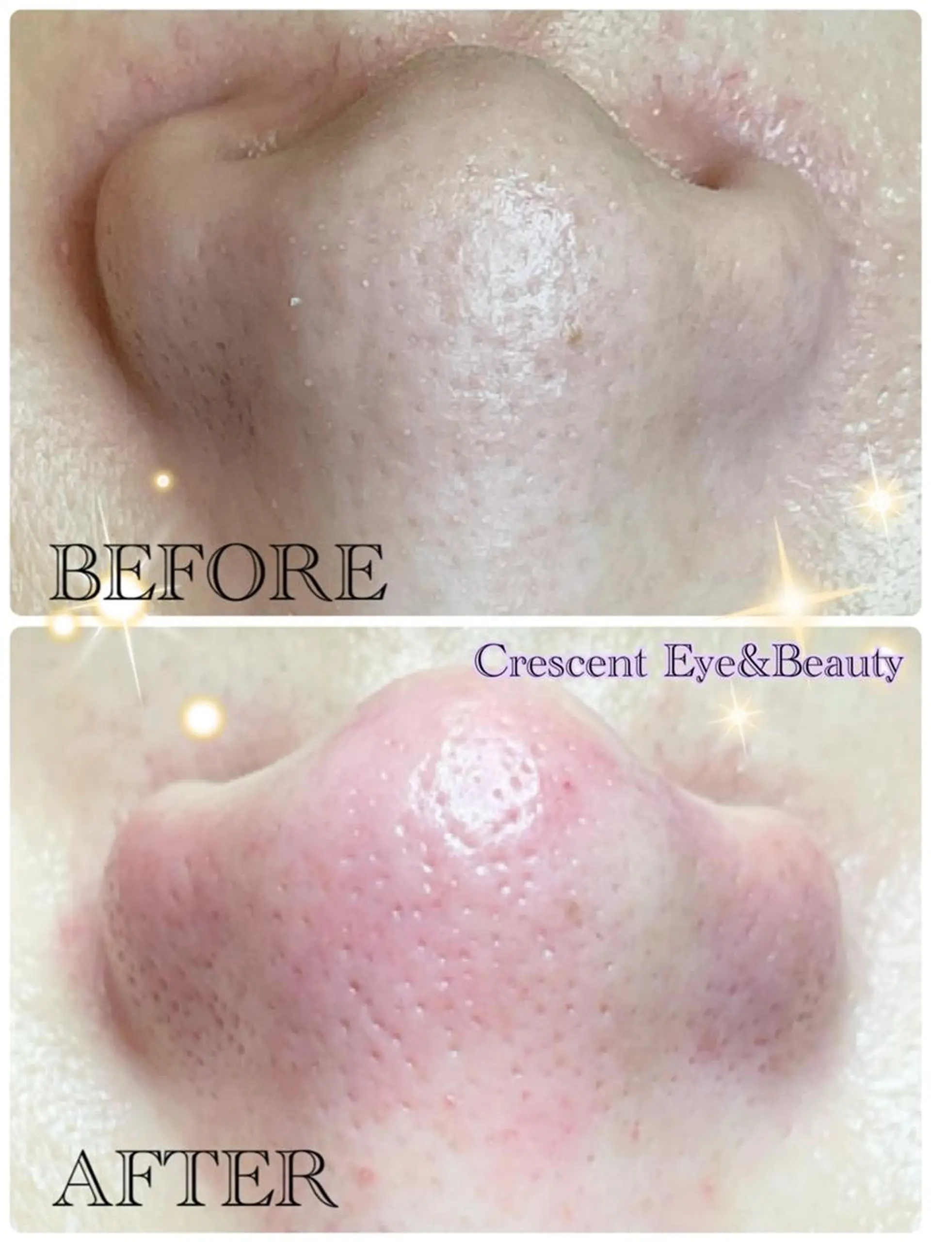 Crescent Beautyのエステ・リラクイメージ