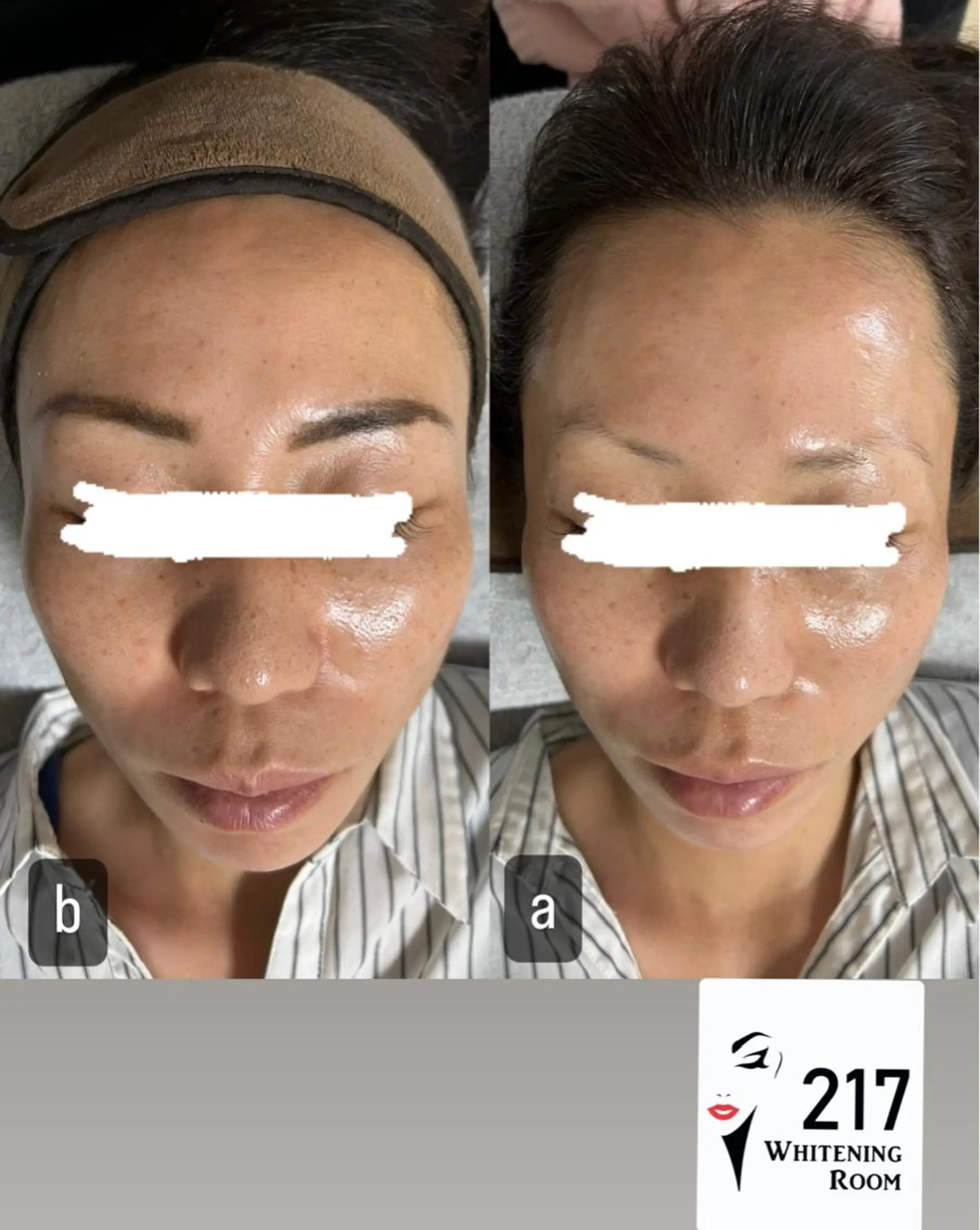 217whitening  room所属・217 ホワイトニングルームのエステ・リラクイメージ