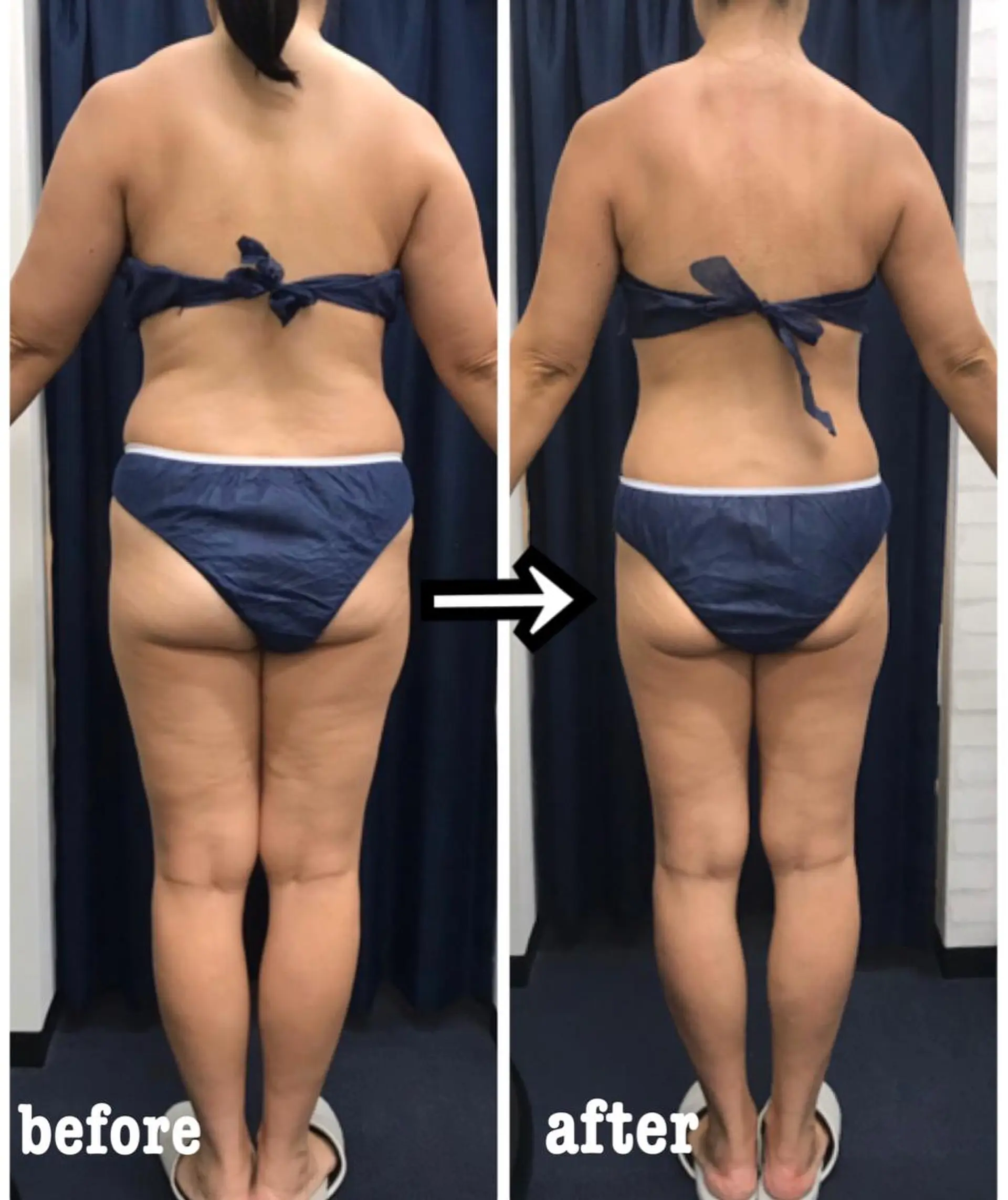 エステ リラク アイトータル ビューティーのエステ・リラクイメージ