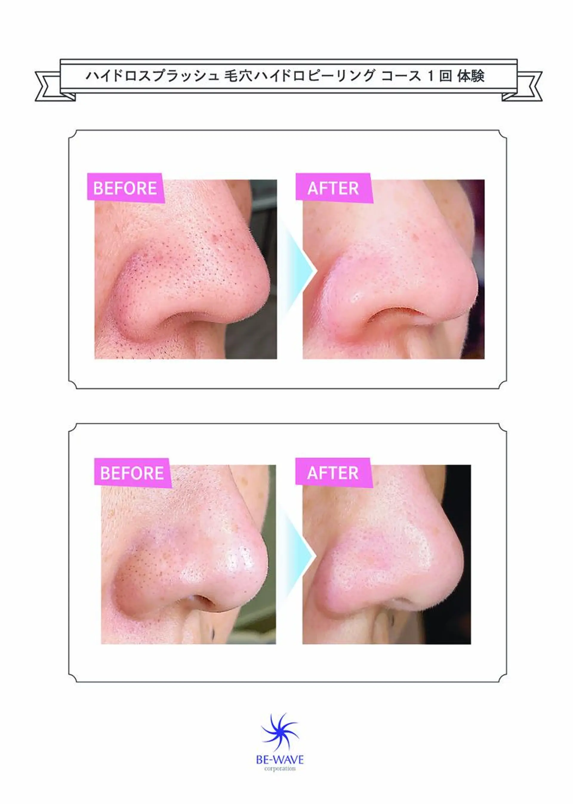 エステ ロイヤル•セラピスト 【Tabata】のマツエク・マツパデザイン