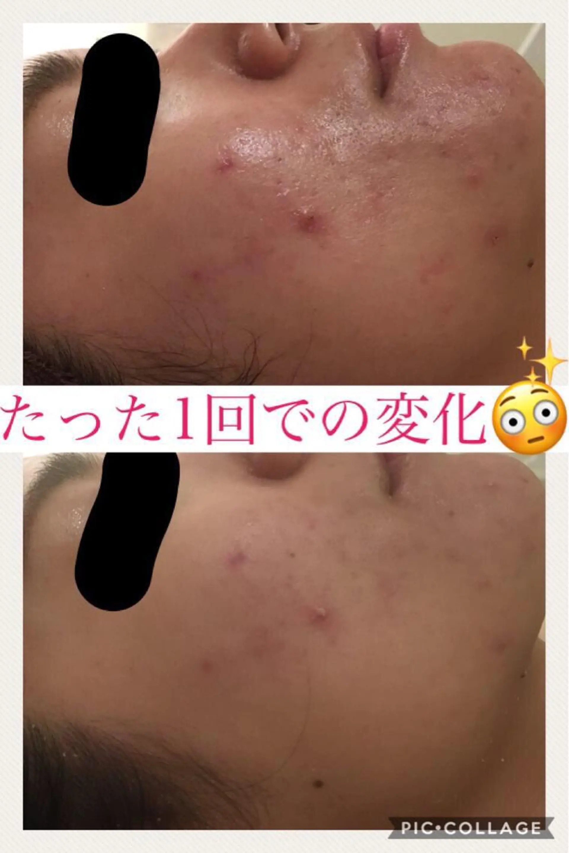 ミディアム カラー パーマ ヘアアレンジ メンズ キッズ ネイル マツエク・マツパ エステ リラク ニキビ・肌質改善専門 ♡人生が変わるサロンのエステ・リラクイメージ