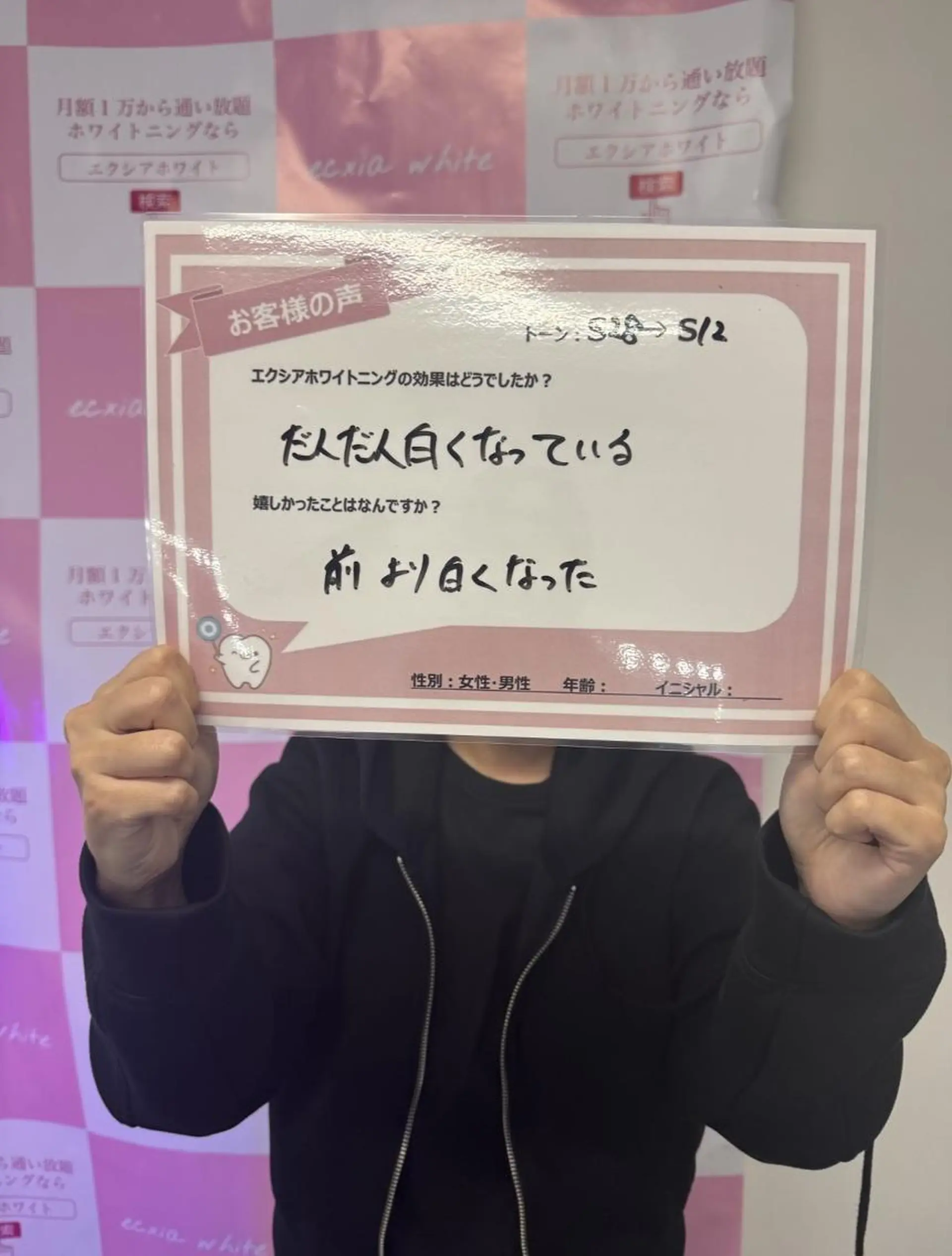 セルフホワイトニング エクシア金山のその他イメージ