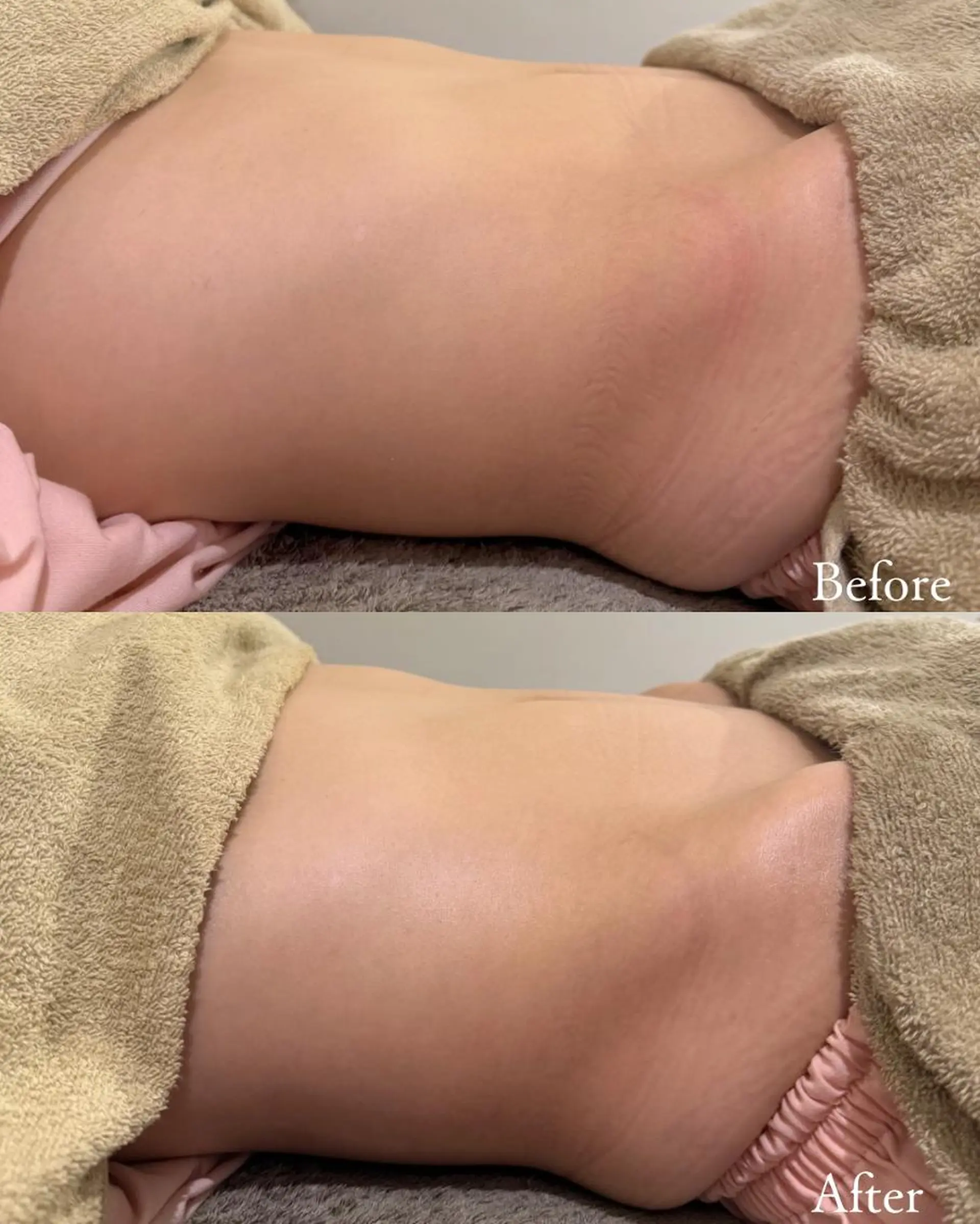 エステ 谷内田 茉莉のエステ・リラクイメージ