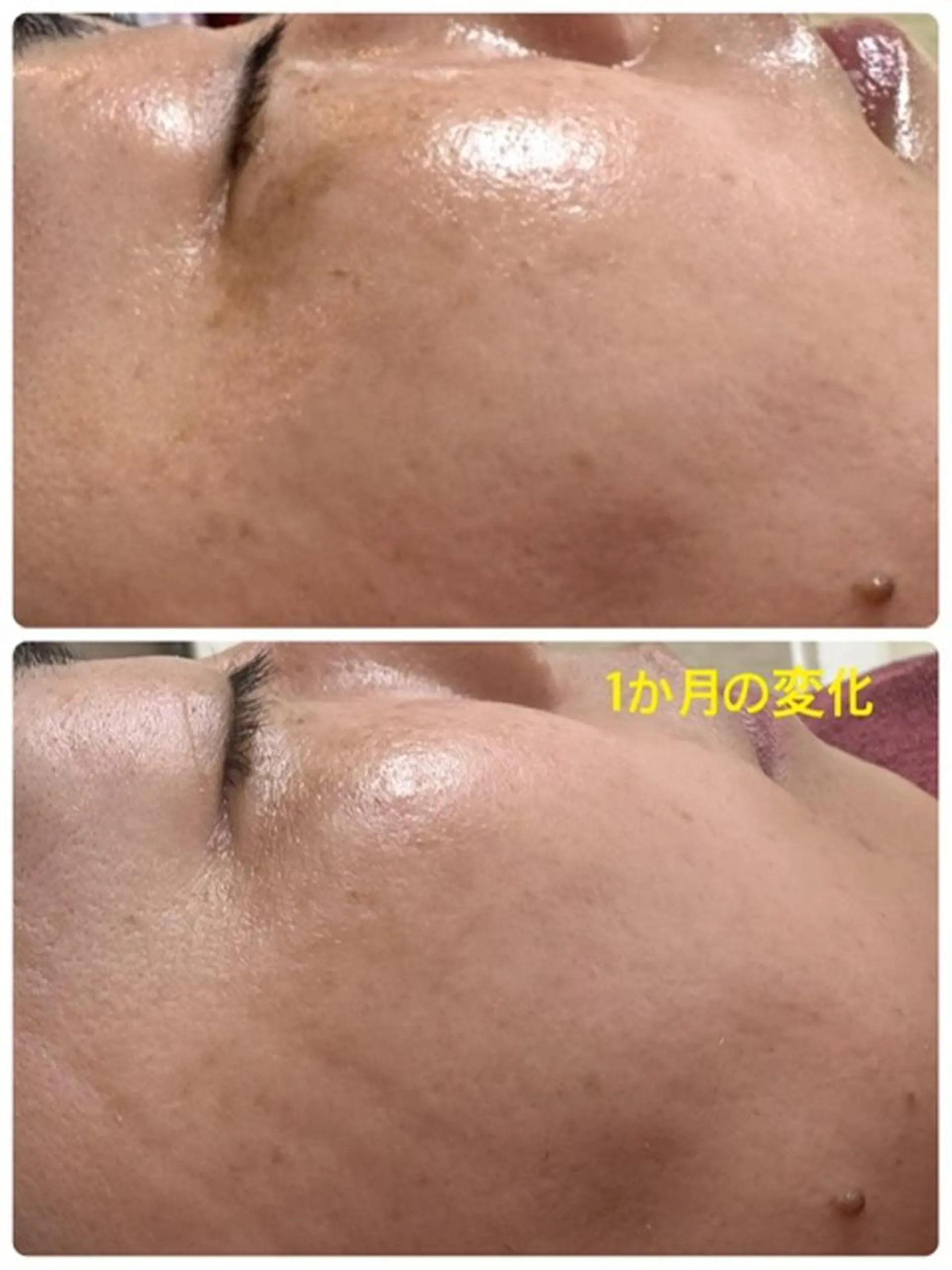 Lien オーナー　山口智嘉のエステ・リラクイメージ