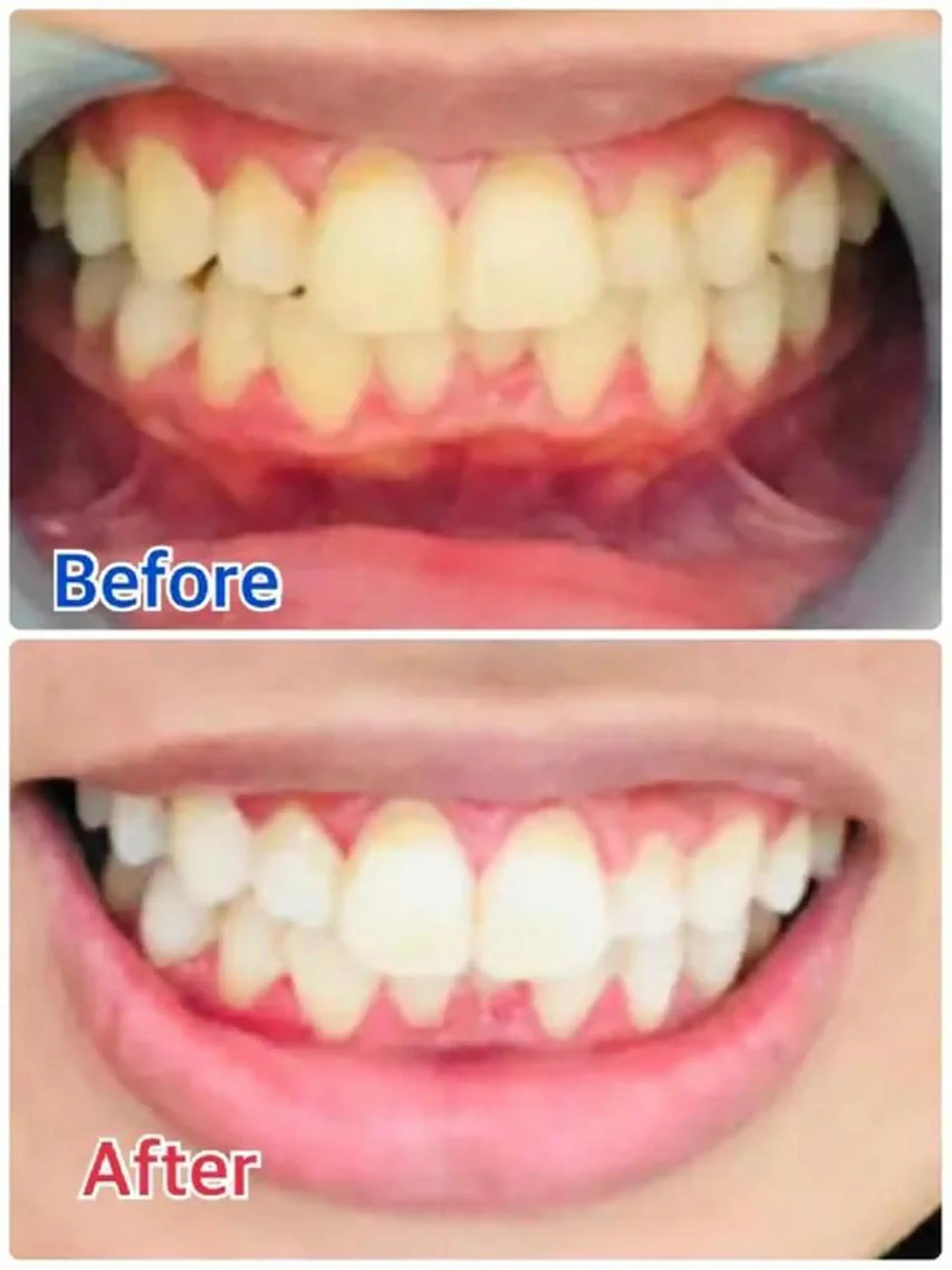 M渋谷 ホワイトニングのエステ・リラクイメージ